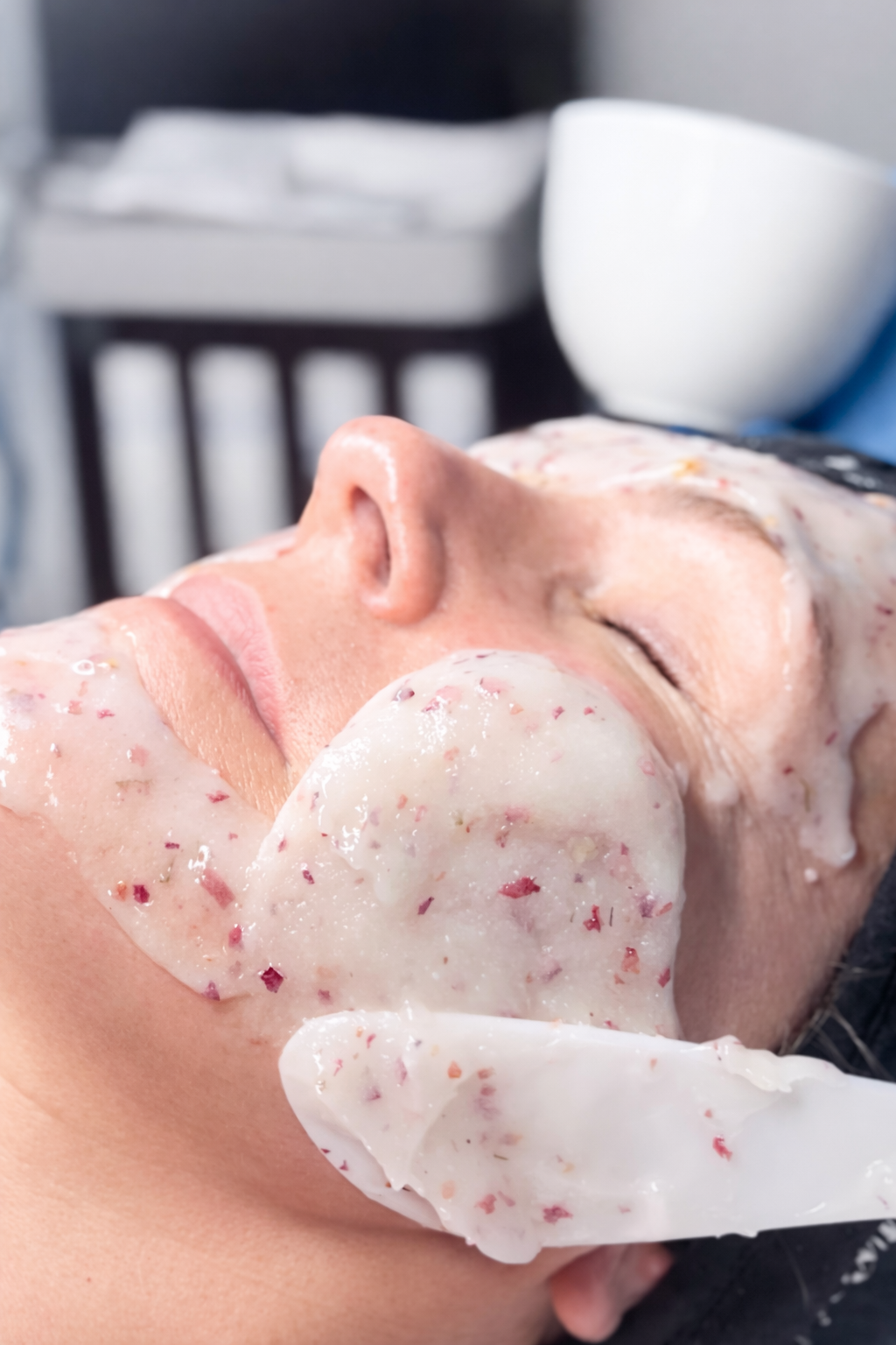 Medical Facials in Burnaby