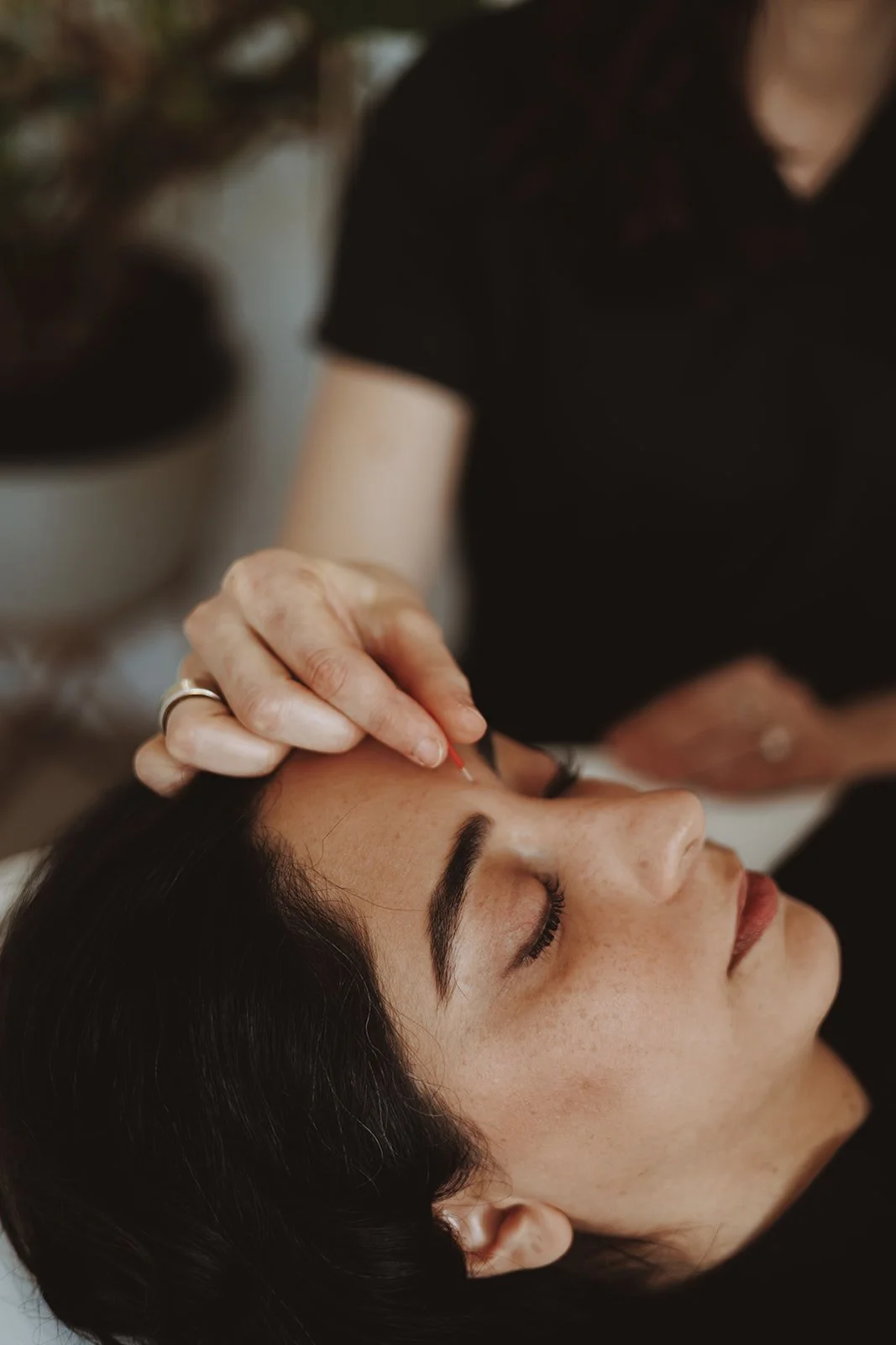 Registered acupuncturist facial Burnaby