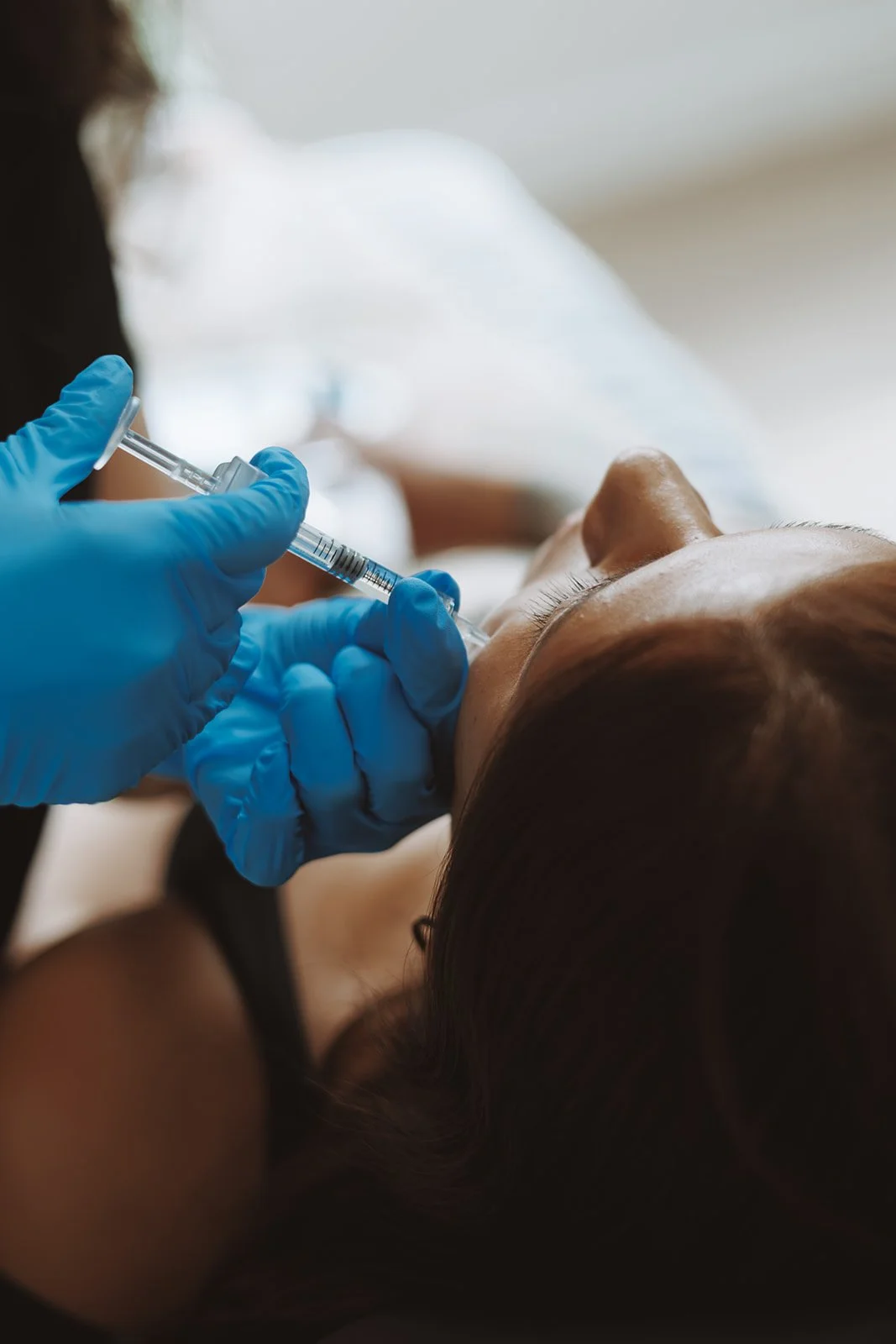 Sculptra collagen stimulating filler Burnaby BC