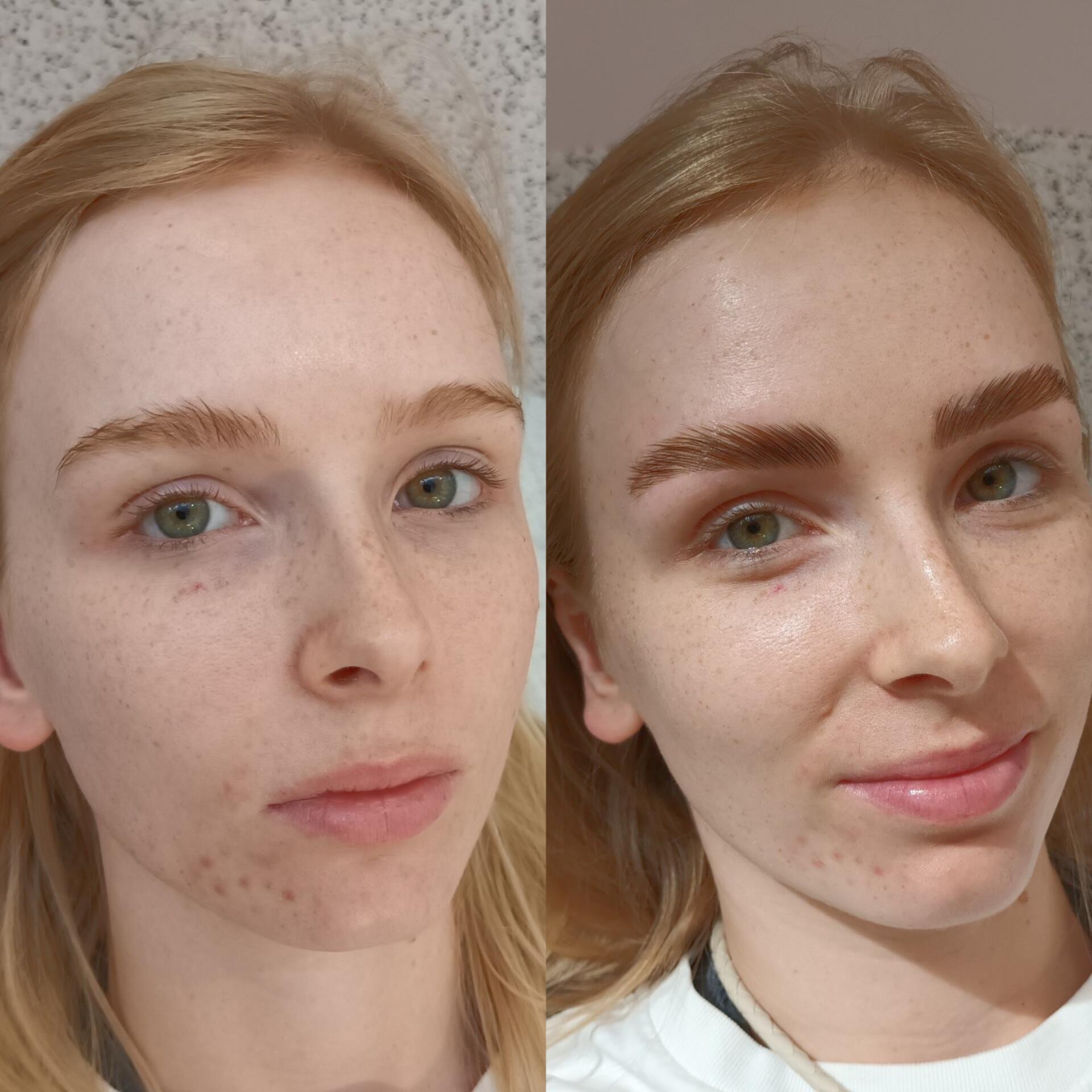 Brow Lamination Learn More About Brow Lamination Services