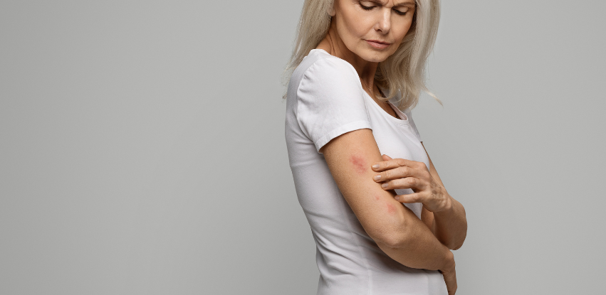 Menopause and shingles