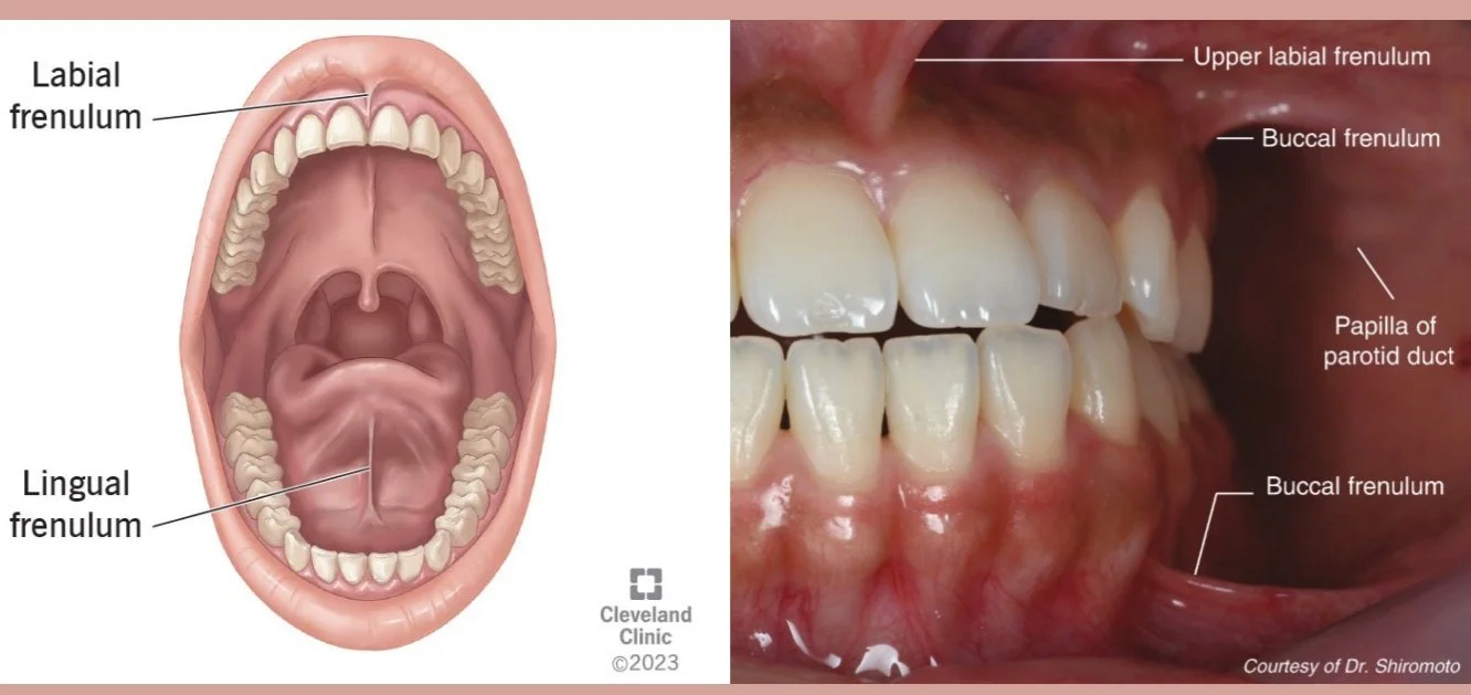 Tongue Tie and Breastfeeding | Does My Baby Have a Tongue Tie? — Sweet ...