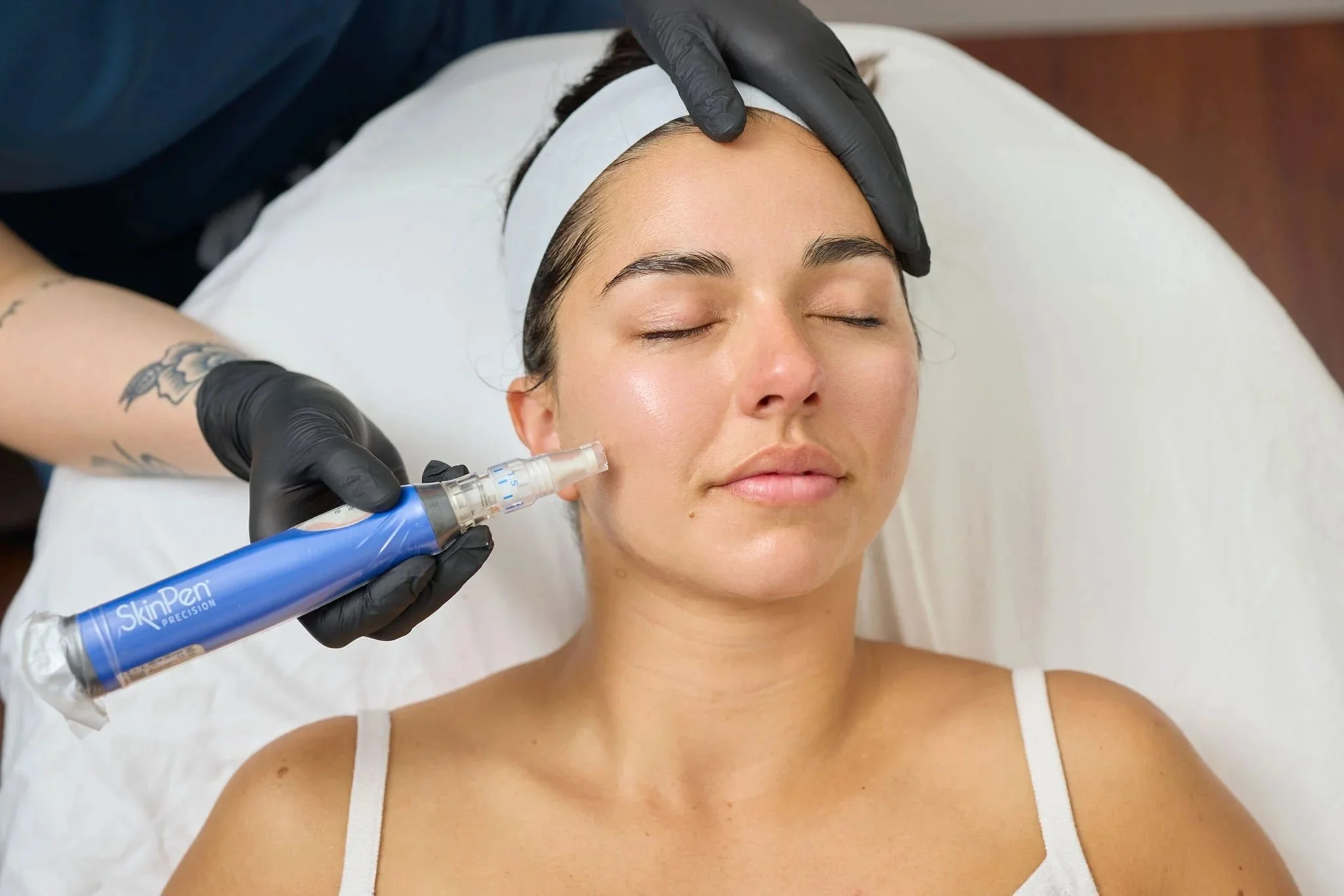 A woman with closed eyes receives a facial microneedling treatment from a gloved professional using a SkinPen device.