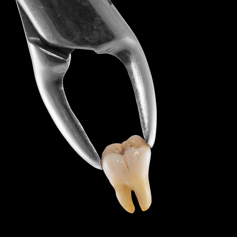 tooth-extraction%D9%A2.jpg