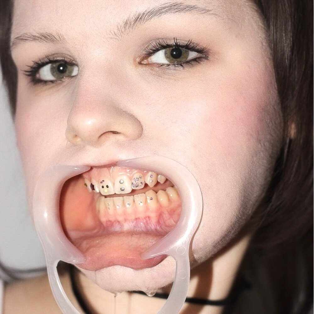 So Icy™ - Tooth Gem Bond – AmiriBeautyBar