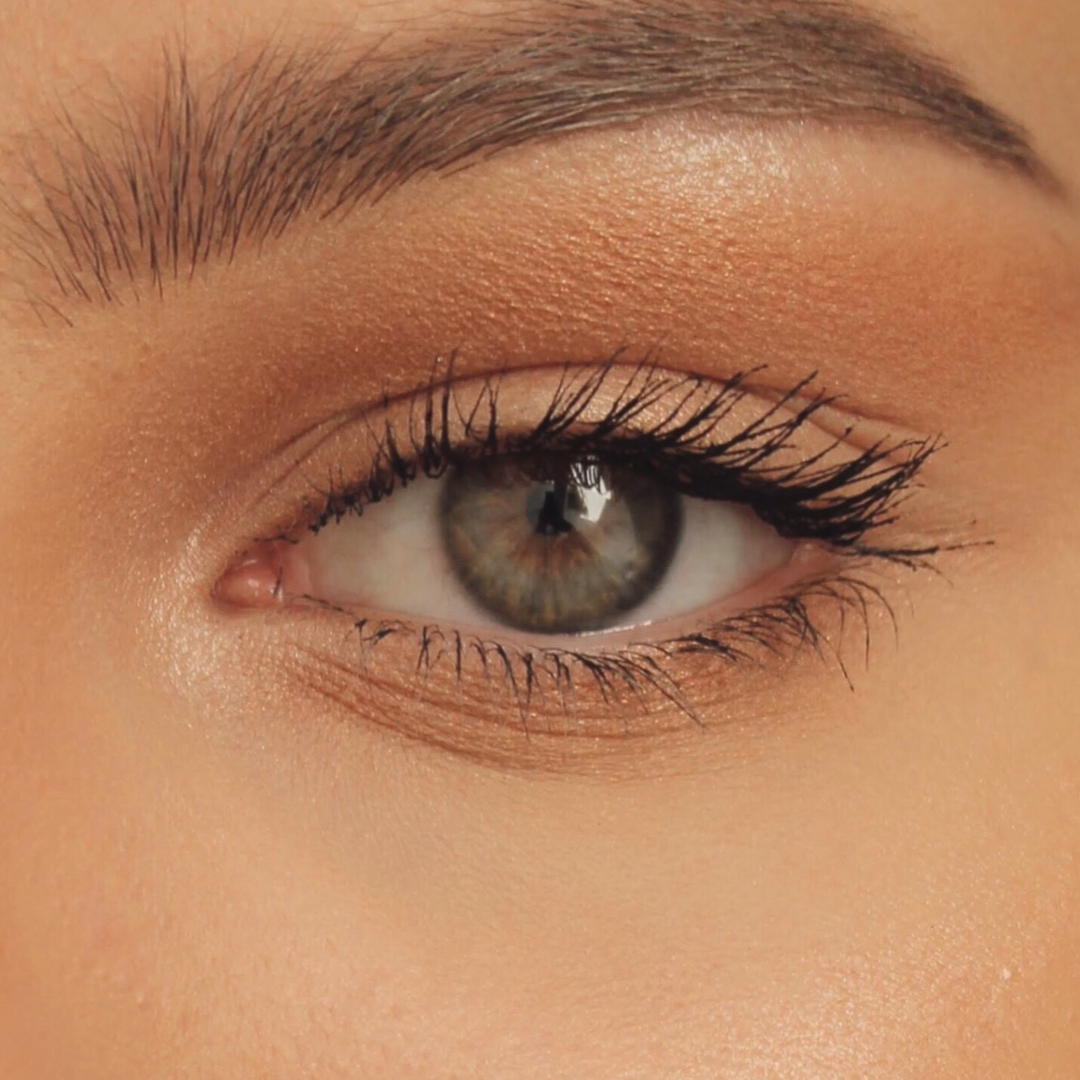 Close-up of eye lid surgery blepharoplasty at Timeless Faces