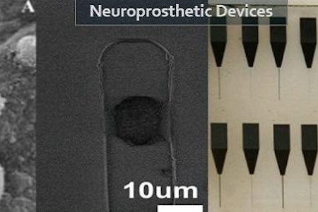 neuroprosthetic-devices.jpg
