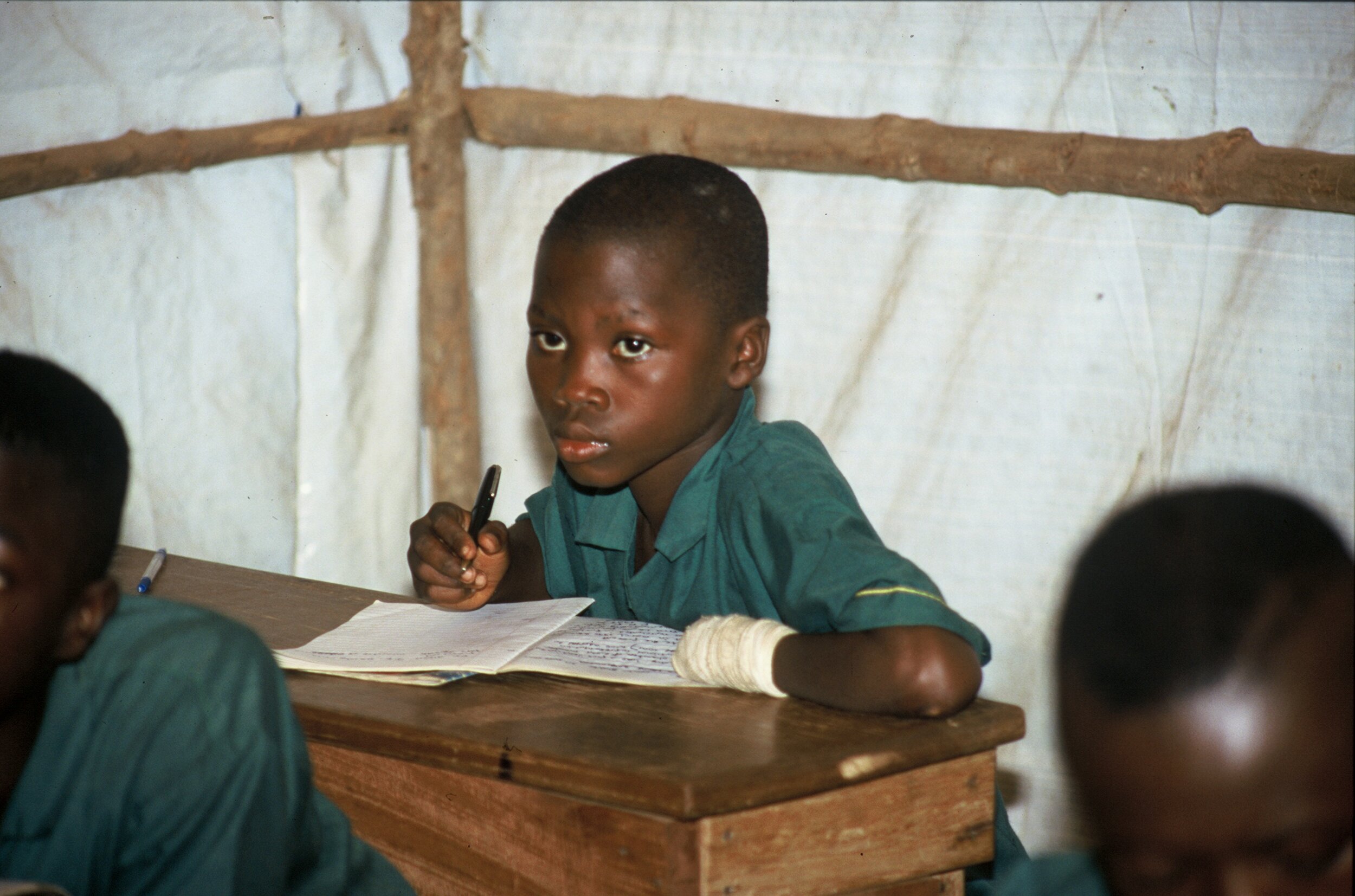Leonean Schoolboy: An Amputee