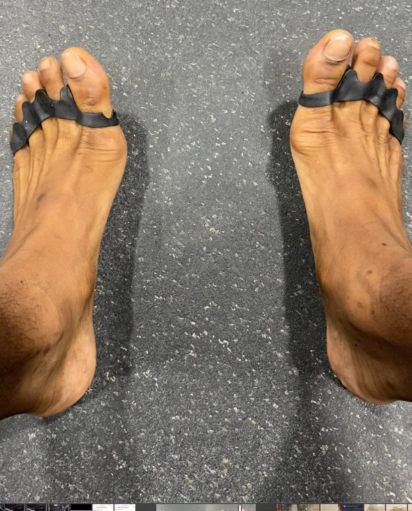 Say Goodbye to Foot Pain with Toe Spacers The Ultimate Guide