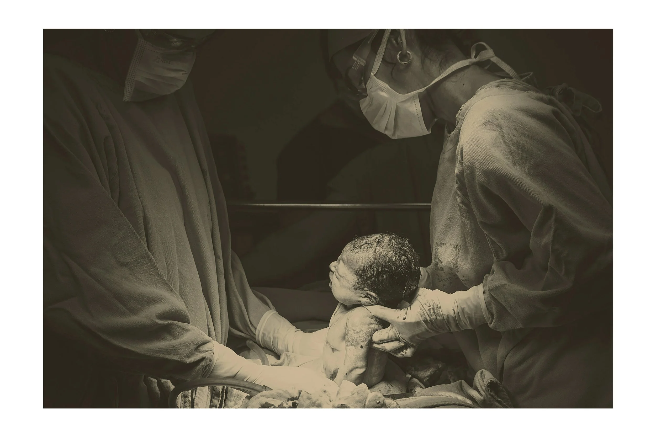 Cesarean birth at a Southern Oregon hospital with the support of a local doula.