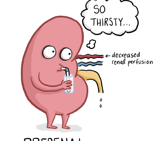 Acute Kidney Injury