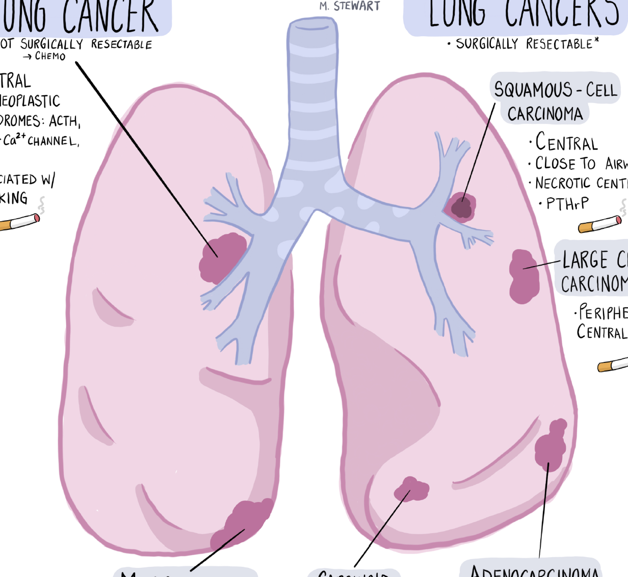 Lung Cancers