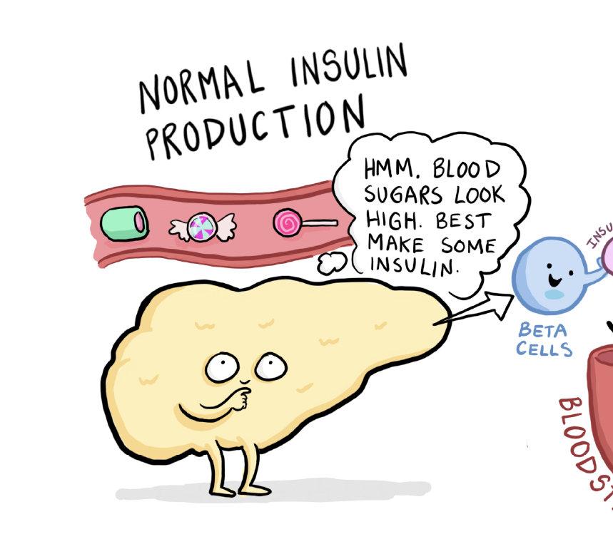 Diabetes Mellitus 