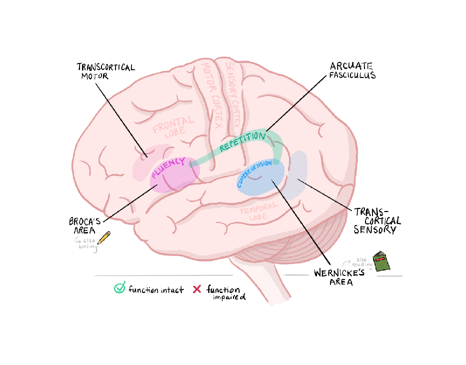 Aphasia