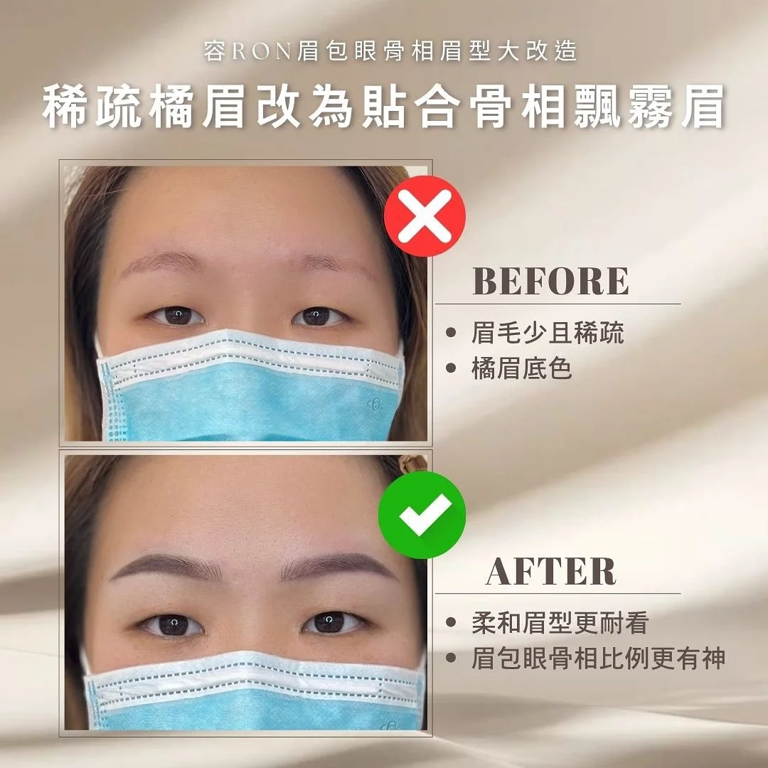 👀只改眉毛，竟然像換了一張臉！？
⠀
很多女生都有「眉形不合比例」、「眉頭太寬」、「眉尾垂下沒精神」的困擾&hellip;
這些問題，其實不只是眉毛不對，
而是眉毛沒有「包住眼型」的關鍵💡
⠀
《容RON半永久紋繡專門院》獨家技術✨【眉包眼招牌飄霧眉】
✔ 根據個人五官比例設計
✔ 柔化眉弓線條，改善兇感與疲憊感
✔ 特調毛流＋霧感，打造自然精緻韓系眉
⠀
改善後：
💖 眼神溫柔有神
💖 輪廓更協調、臉顯小
💖 氣質直接升級成溫柔感女主角
⠀
這不是套模板畫眉，而是真正讓「眉毛回歸五官