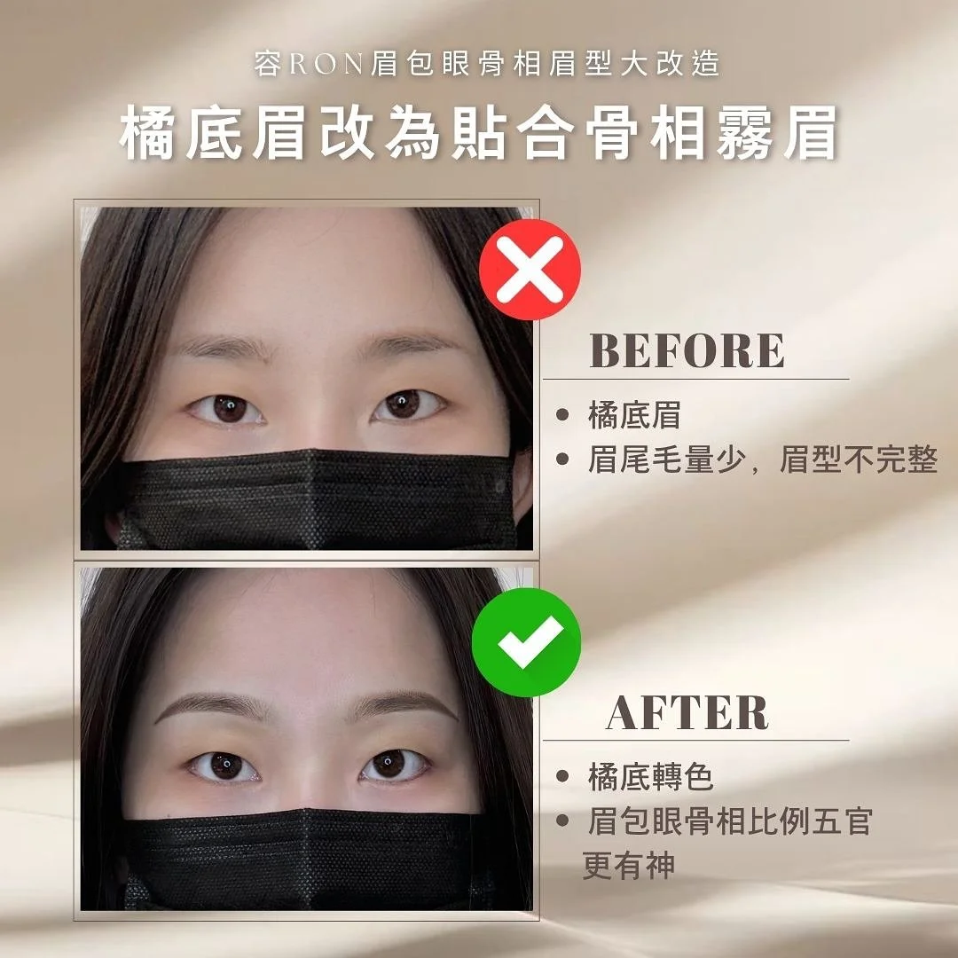 👀只改眉毛，竟然像換了一張臉！？
⠀
很多女生都有「眉形不合比例」、「眉頭太寬」、「眉尾垂下沒精神」的困擾&hellip;
這些問題，其實不只是眉毛不對，
而是眉毛沒有「包住眼型」的關鍵💡
⠀
《容RON半永久紋繡專門院》獨家技術✨【眉包眼招牌飄霧眉】
✔ 根據個人五官比例設計
✔ 柔化眉弓線條，改善兇感與疲憊感
✔ 特調毛流＋霧感，打造自然精緻韓系眉
⠀
改善後：
💖 眼神溫柔有神
💖 輪廓更協調、臉顯小
💖 氣質直接升級成溫柔感女主角
⠀
這不是套模板畫眉，而是真正讓「眉毛回歸五官