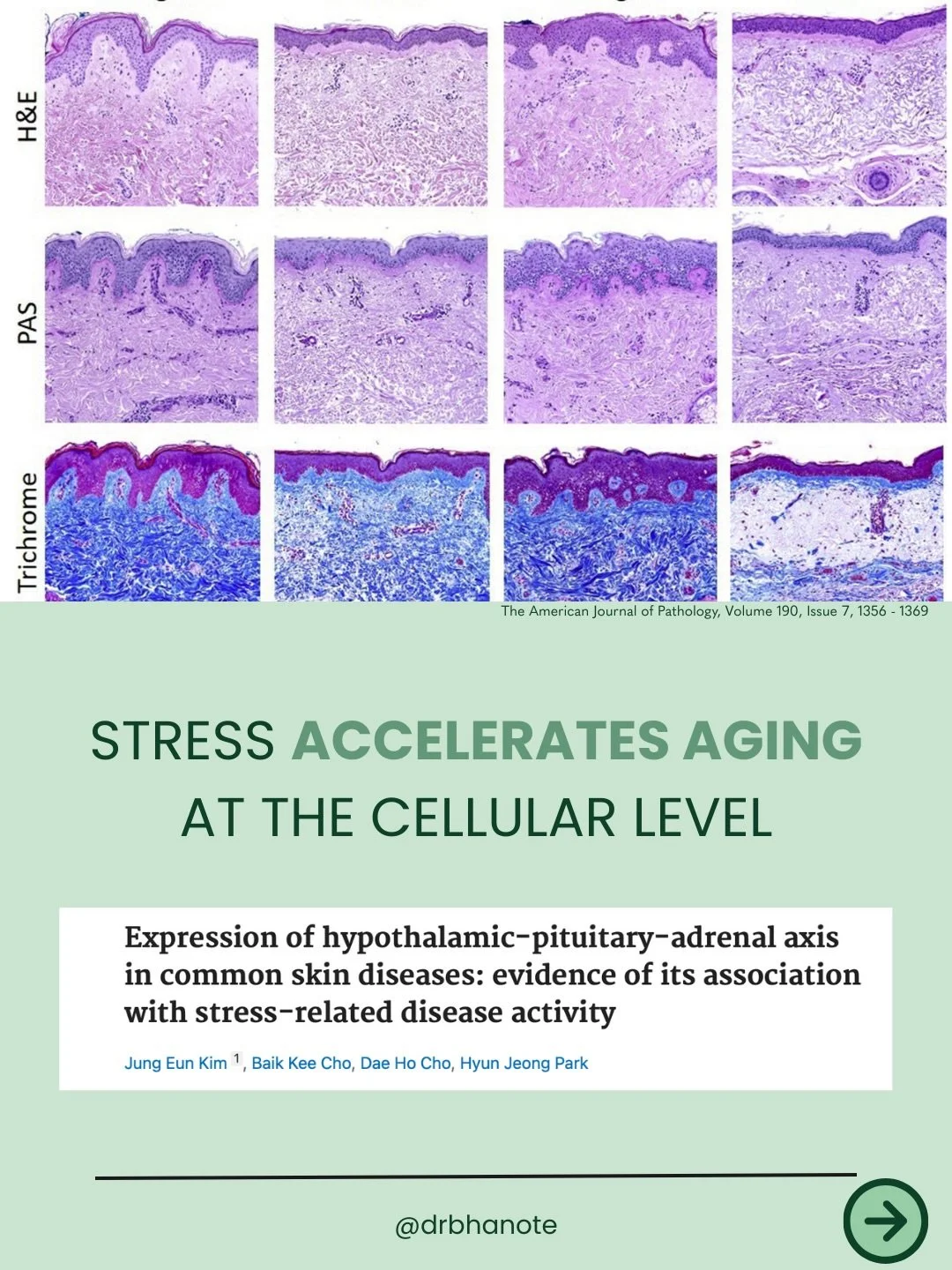 Research shows that chronic stress alters nervous system signaling, increases inflammation and oxidative stress, and accelerates biological aging at the cellular level.

This carousel breaks down how stress physiology impacts skin integrity, tissue r