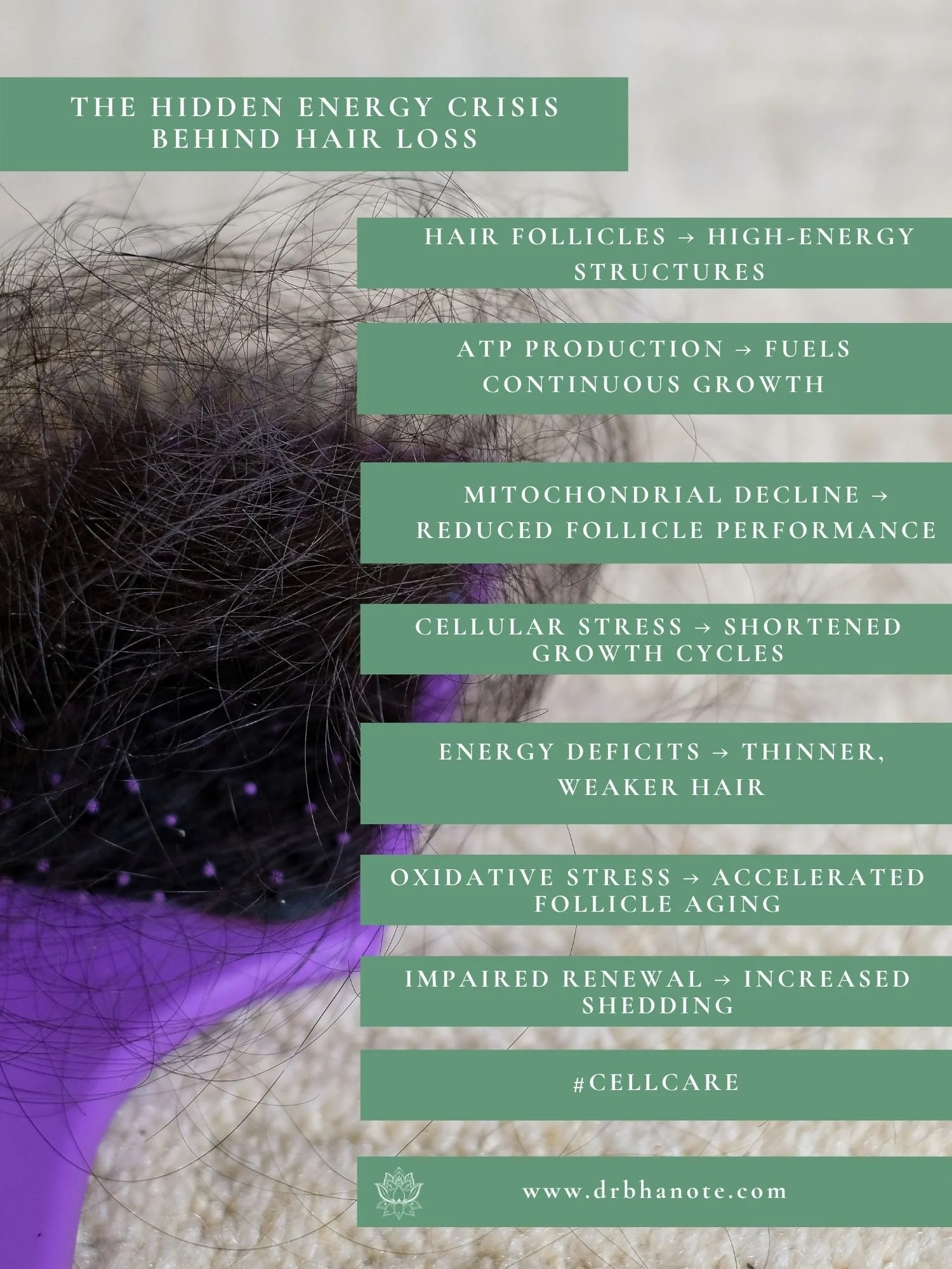 Dr. Monisha Bhanote infographic on mitochondrial dysfunction, hair loss, and cellular aging.