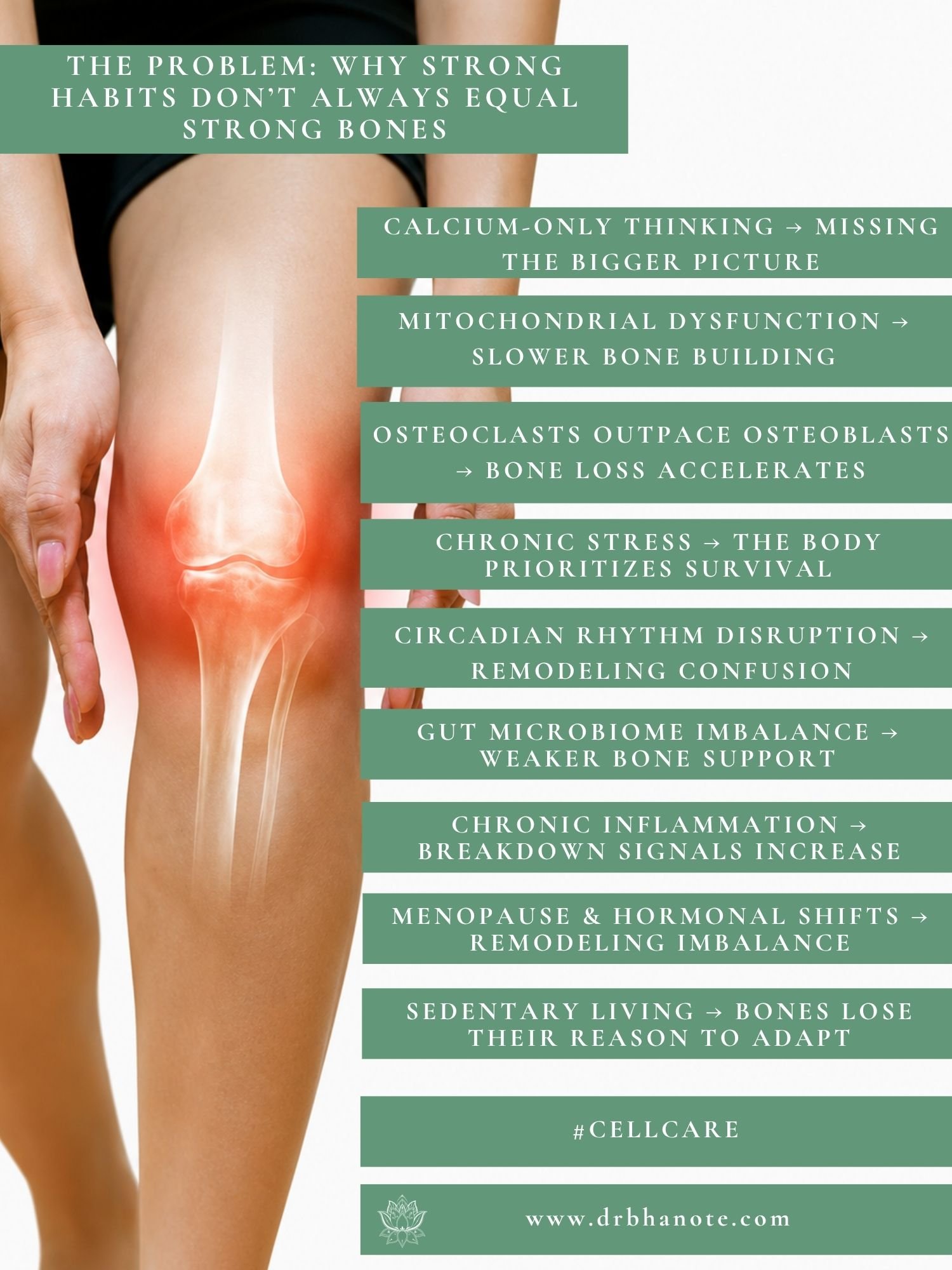 Dr. Monisha Bhanote infographic showing how stress, gut health, mitochondria, and hormones influence bone health