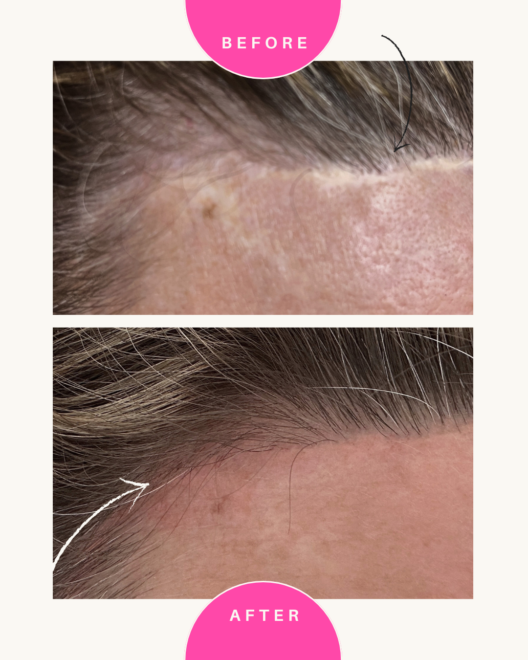 Green and Beige Minimalist Skincare Before After Collage Instagram Post - Copy.png