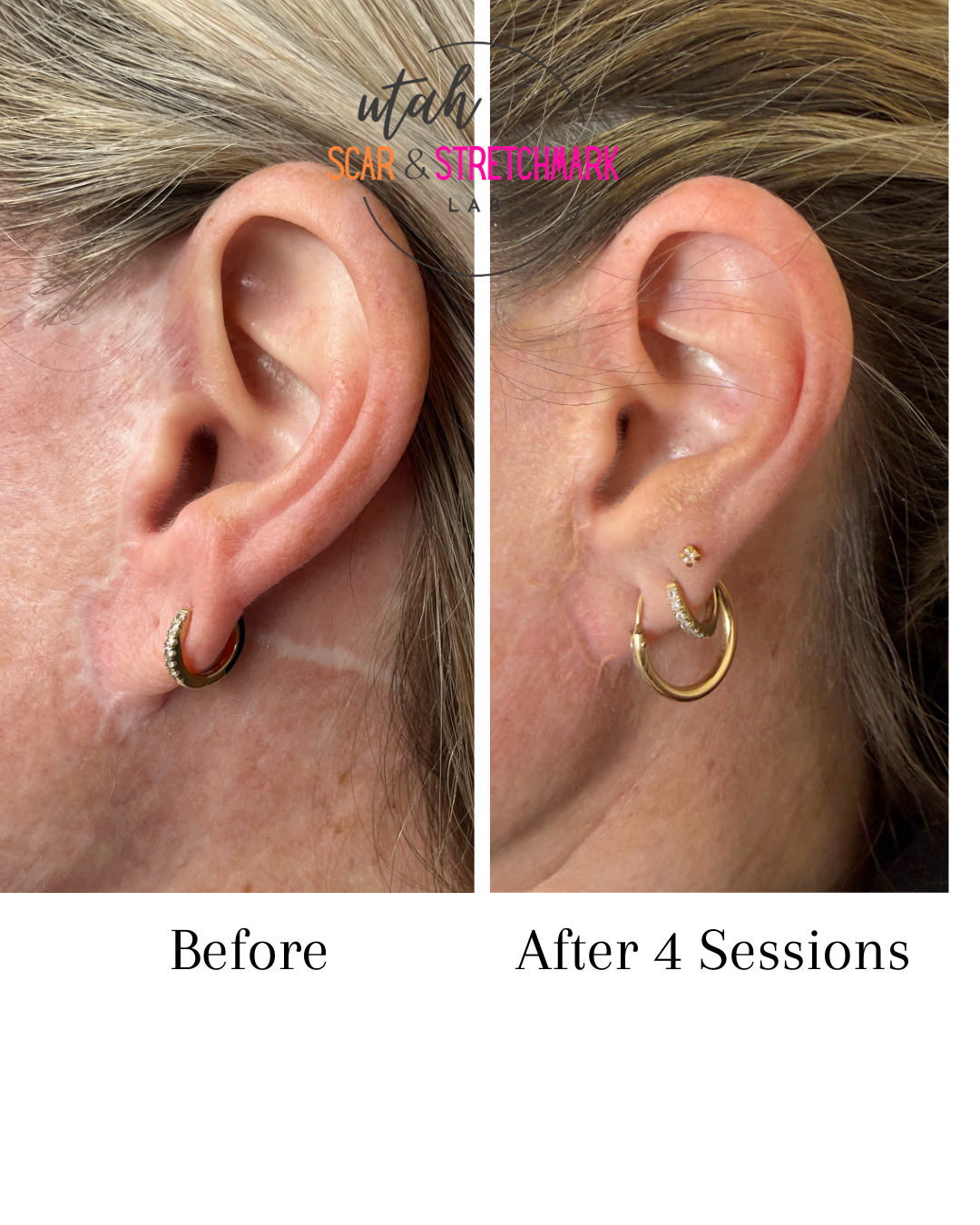 Copy of Copy of Copy of Neutral Minimalist Skincare Before and After Instagram Post (1).png