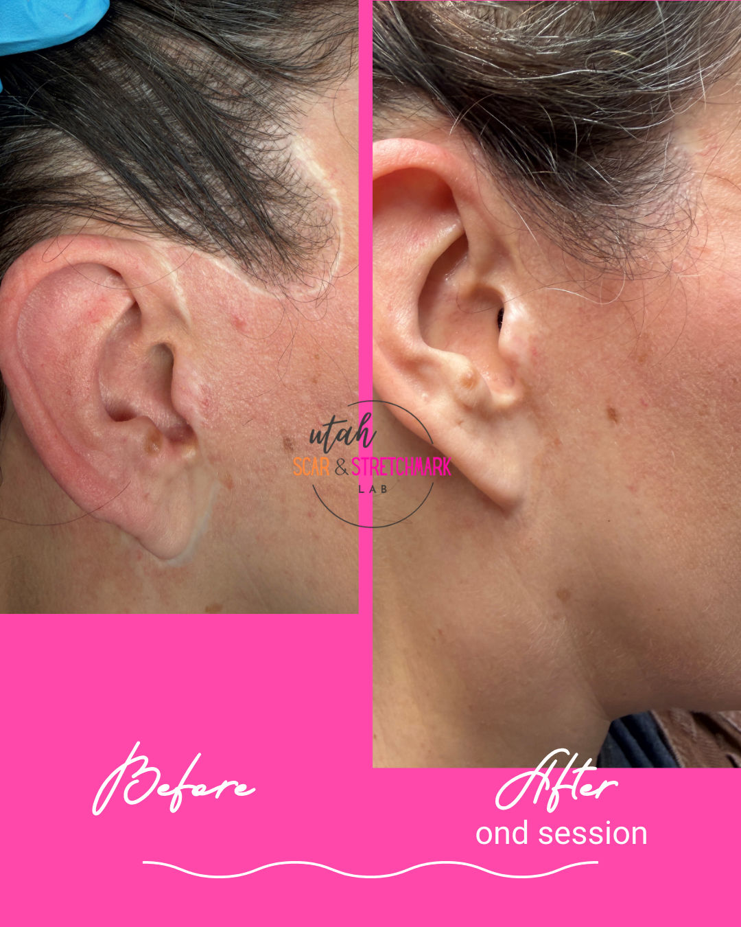 Copy of Neutral Minimalist Skincare Before and After Instagram Post.png