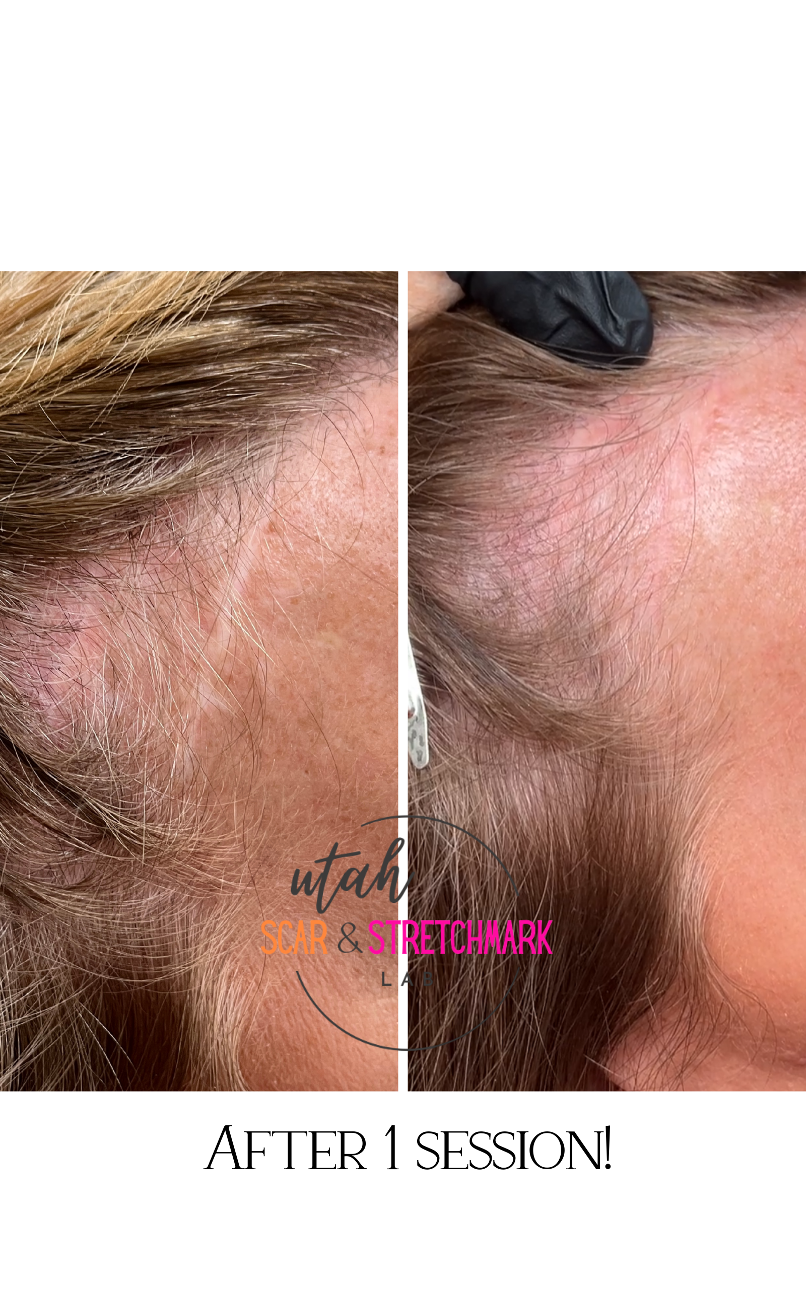 After 1 session!.png