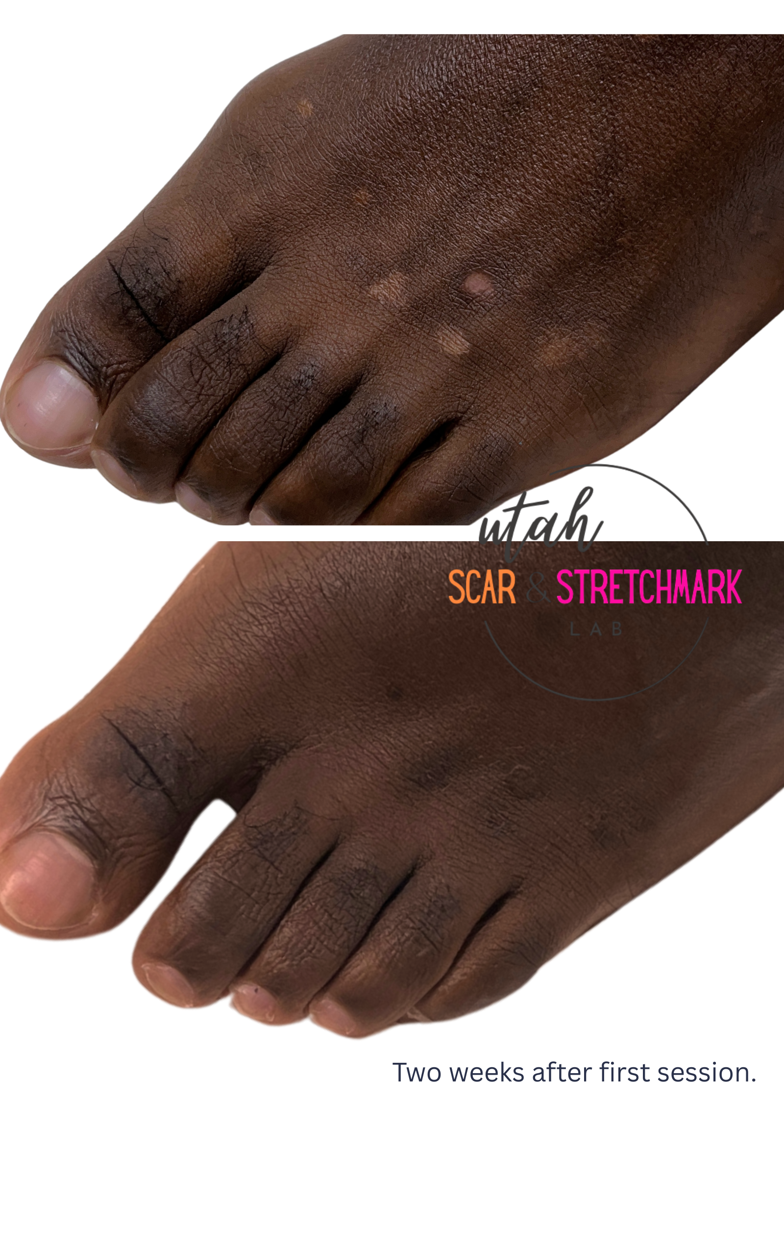 Copy of Copy of After 1 session!.png