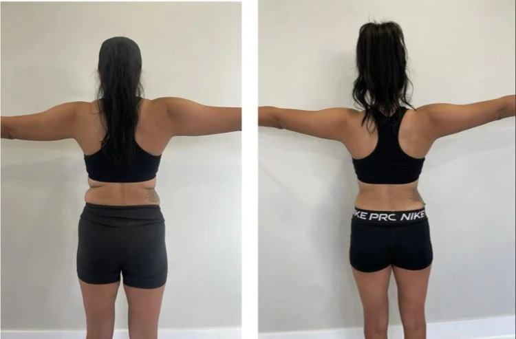 Side-by-side comparison photo of a woman's back before and after a fitness transformation. In the 'before' photo, she has more body fat and looser skin. In the 'after' photo, she appears more toned with less body fat and tighter skin.