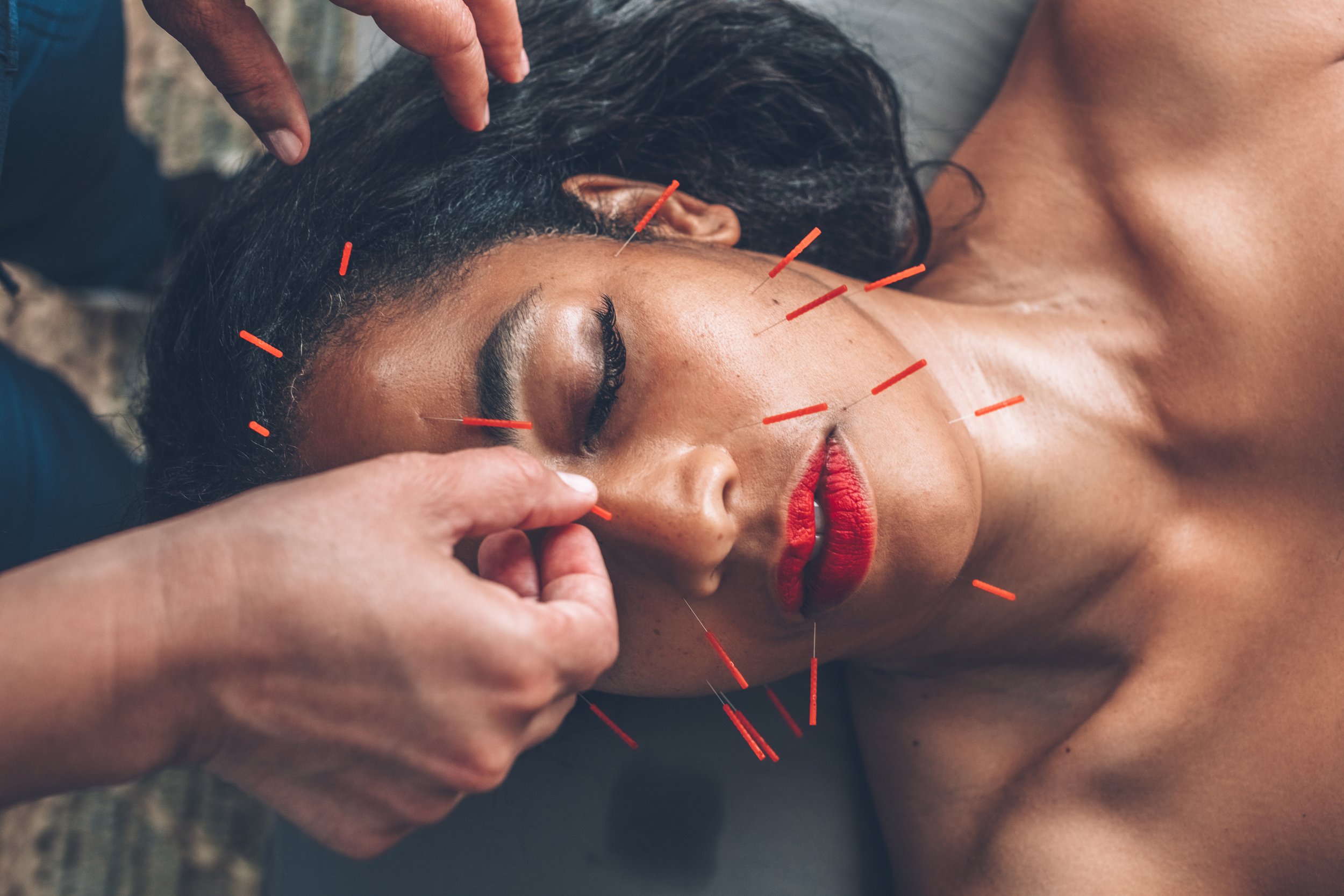 Woman lying with eyes closed during a facial acupuncture treatment.