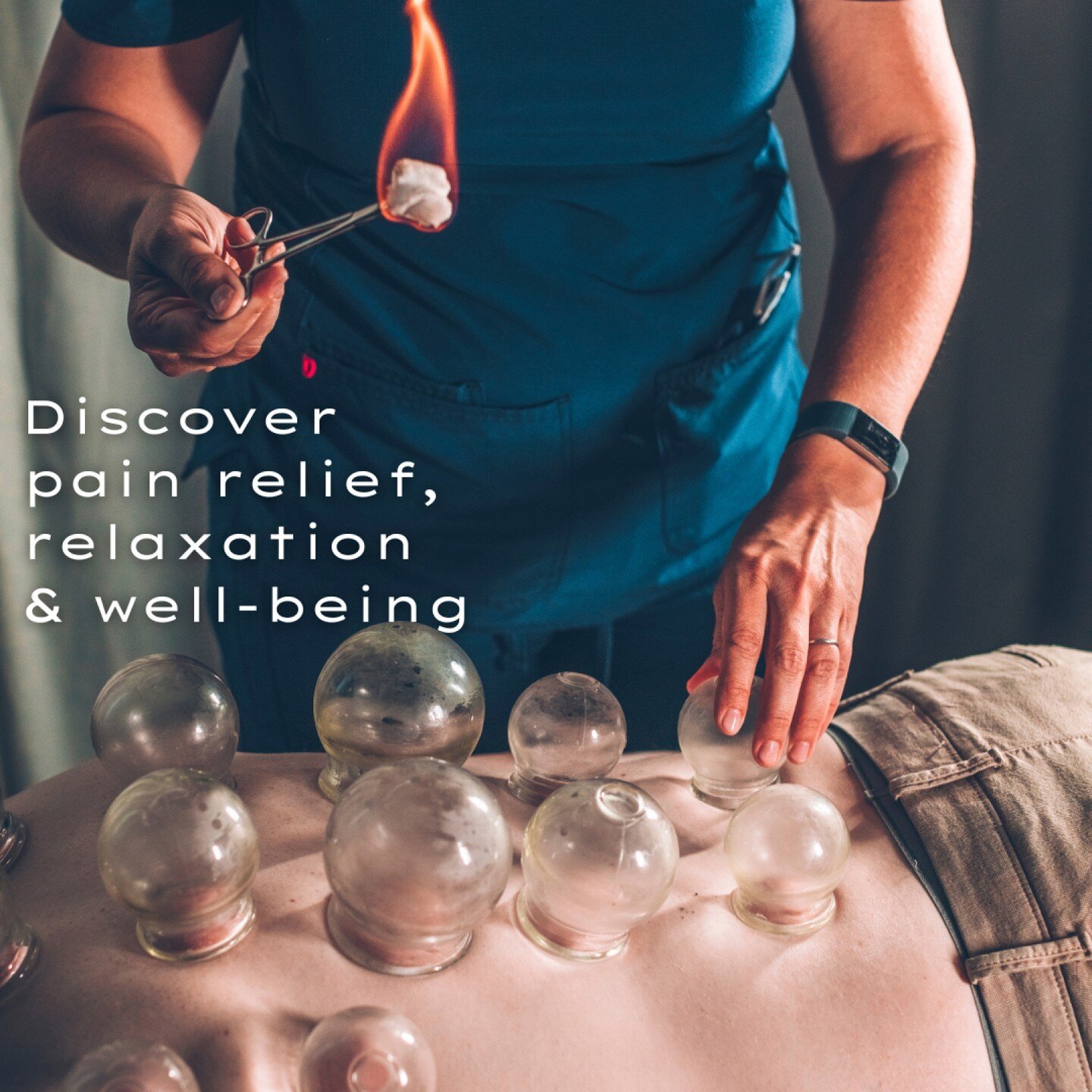 Cupping therapy has been popularized in recent years by athletes and celebrities, but it&rsquo;s not new. It dates back to ancient Egyptian, Chinese, and Middle Eastern cultures. 
🔥 
The cups create suction, and this suction creates movement of ener