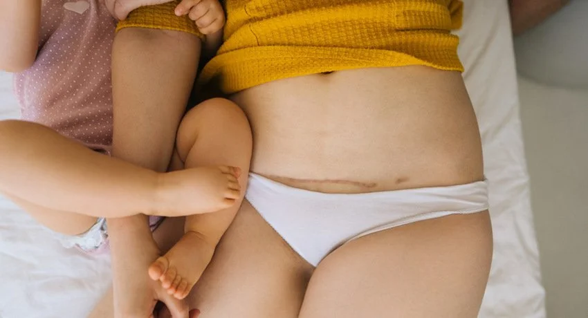 April is C Section Awareness Month