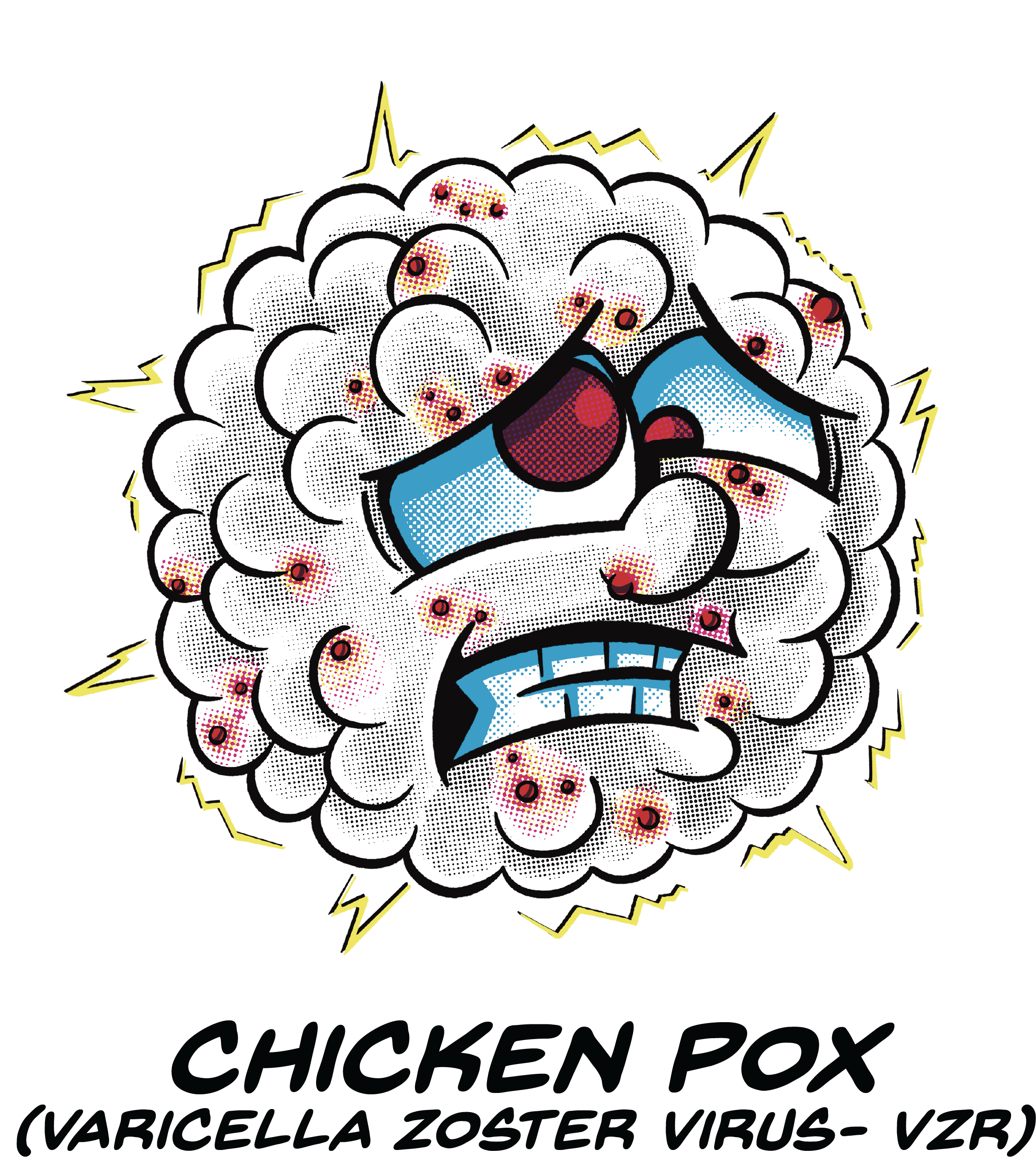 EHM Germs- Chicken Pox.png