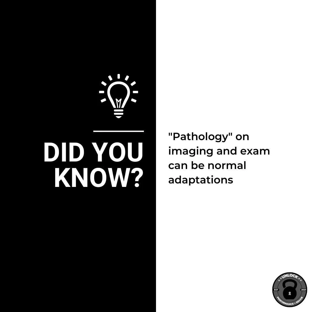 Have you been told that one leg is longer than the other or one of your hips is rotated a certain way? 

Often times these are findings that have been there long before your injury so their relevance to your current painful episode is questionable. 
