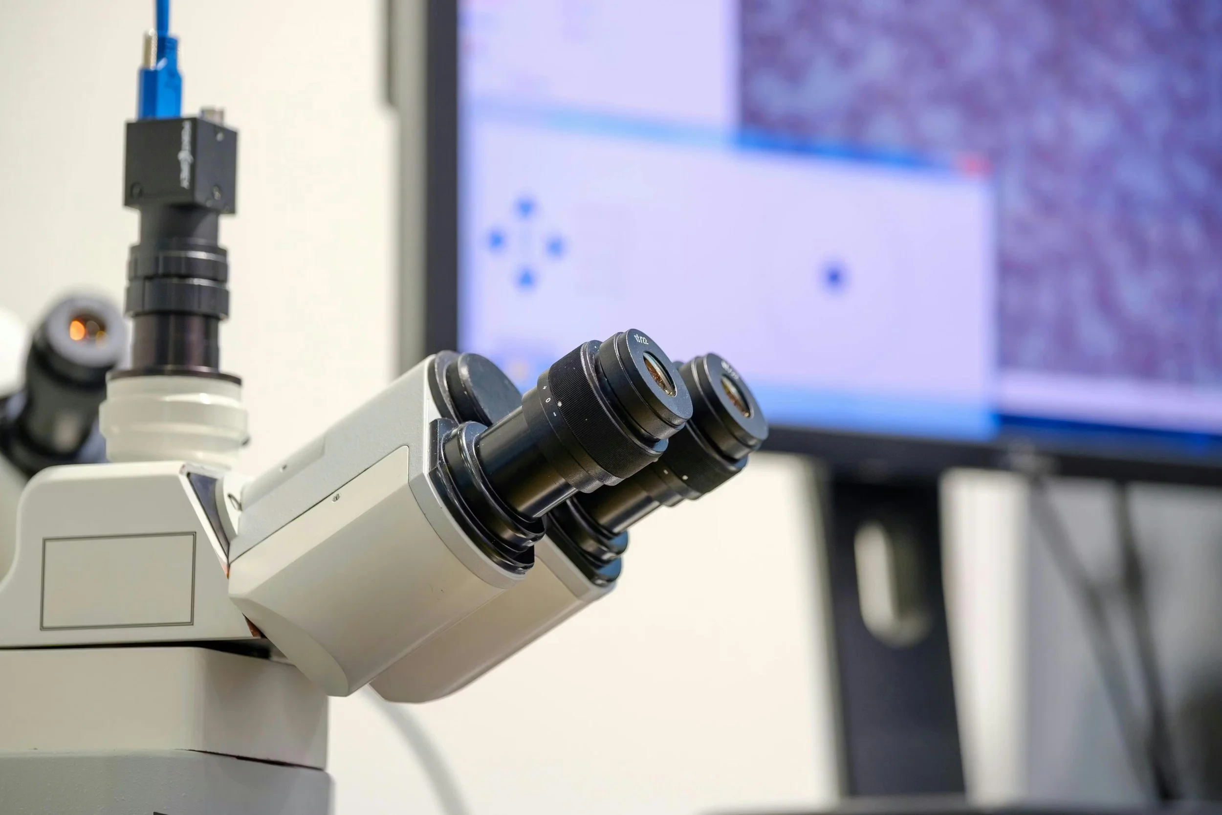 From glass to gigapixels: A GI pathology lab’s journey into digital pathology