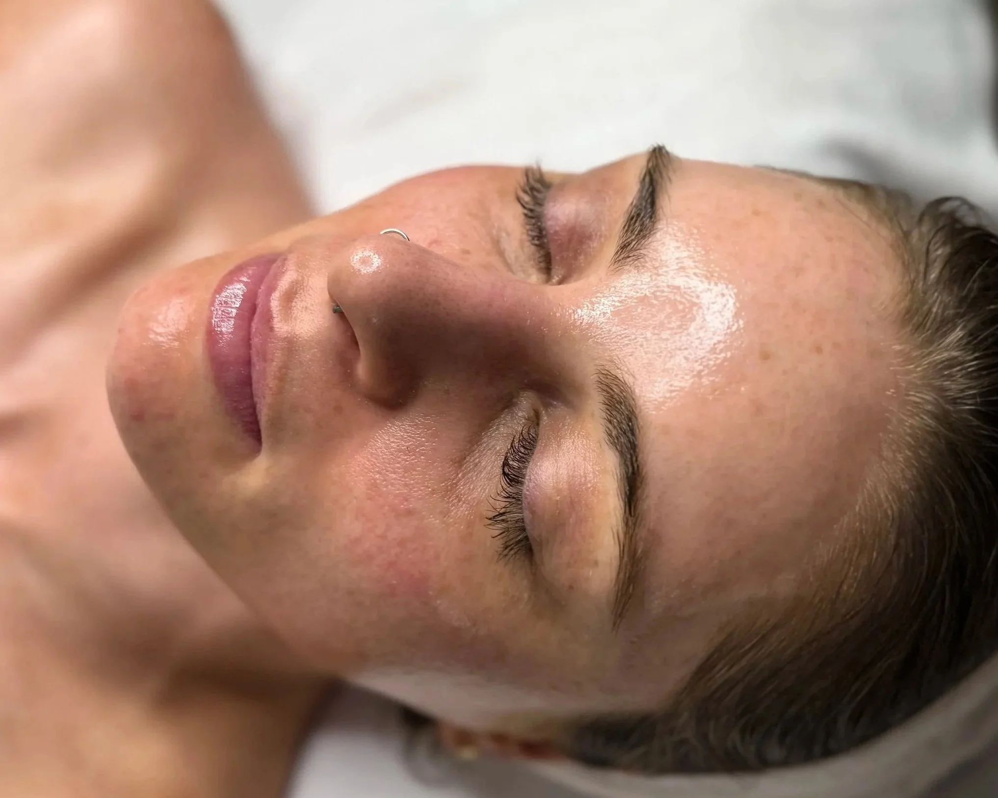 corrective facial treatment for glowing skin in Redding, California