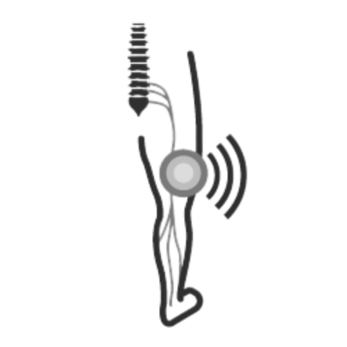 Sciatica pain relief Sciatica treatment options Natural sciatica remedies Chronic sciatica pain Acute sciatica pain Sciatica exercises Sciatica stretches Sciatica symptoms Sciatica relief through chiropractic care Non-surgical sciatica treatment opti