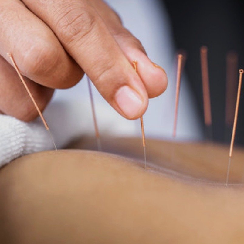 Does the idea of needles cause you to feel lightheaded or queasy, preventing you from trying acupuncture? In my June newsletter I interview Betty Shuford of Pine Street Acupuncture getting all the 411 on this ancient practice. Maybe this is the incen