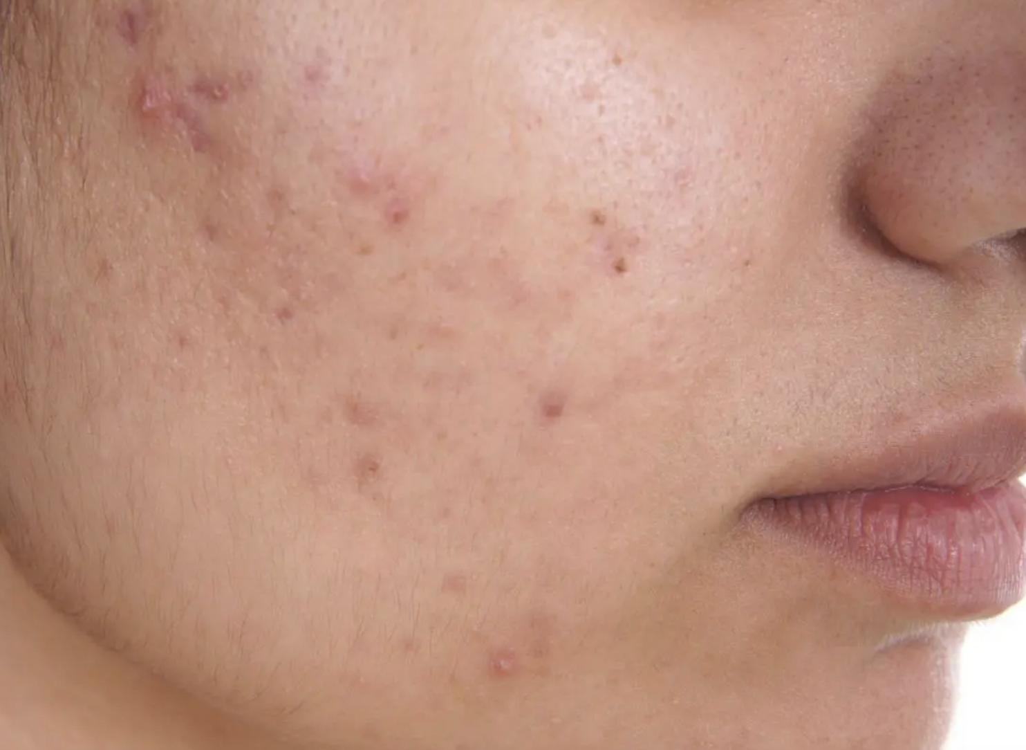Image from Medical News Today