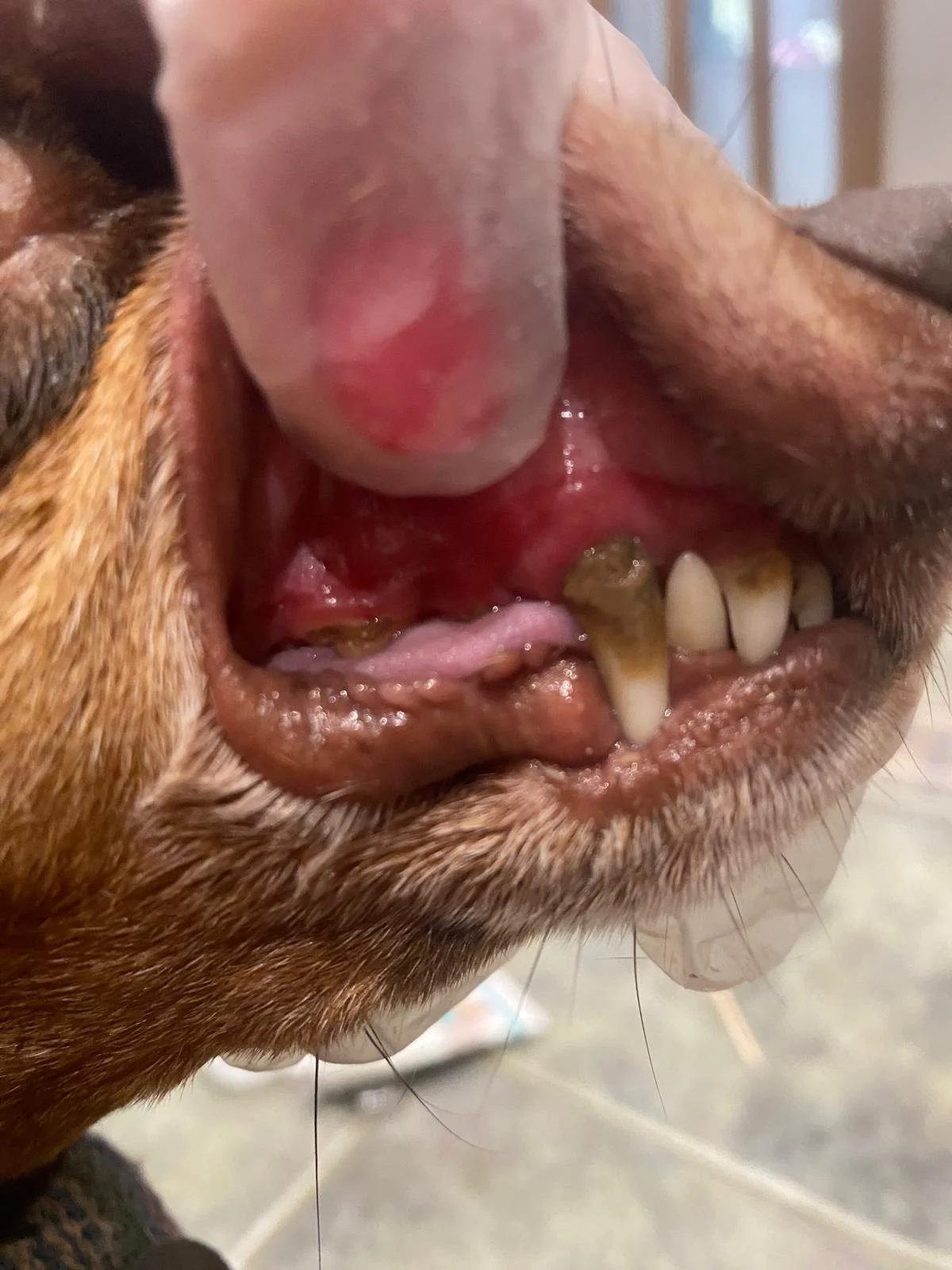 Before first ultrasonic teeth clean