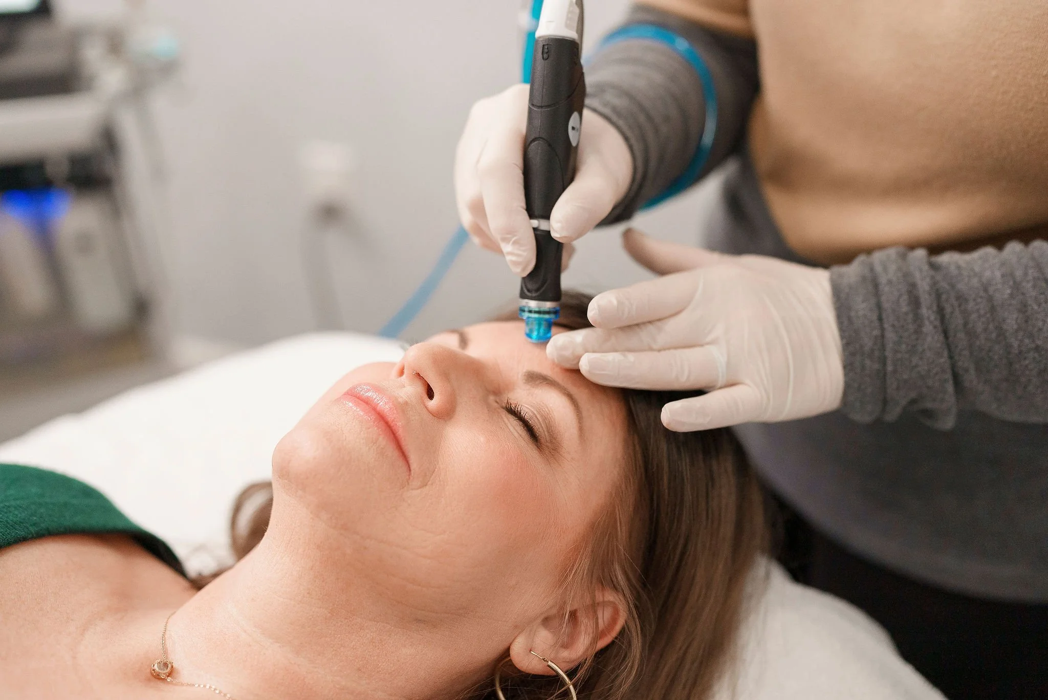 a woman getting a hydrafacial treatment in Chillicothe, Ohio.