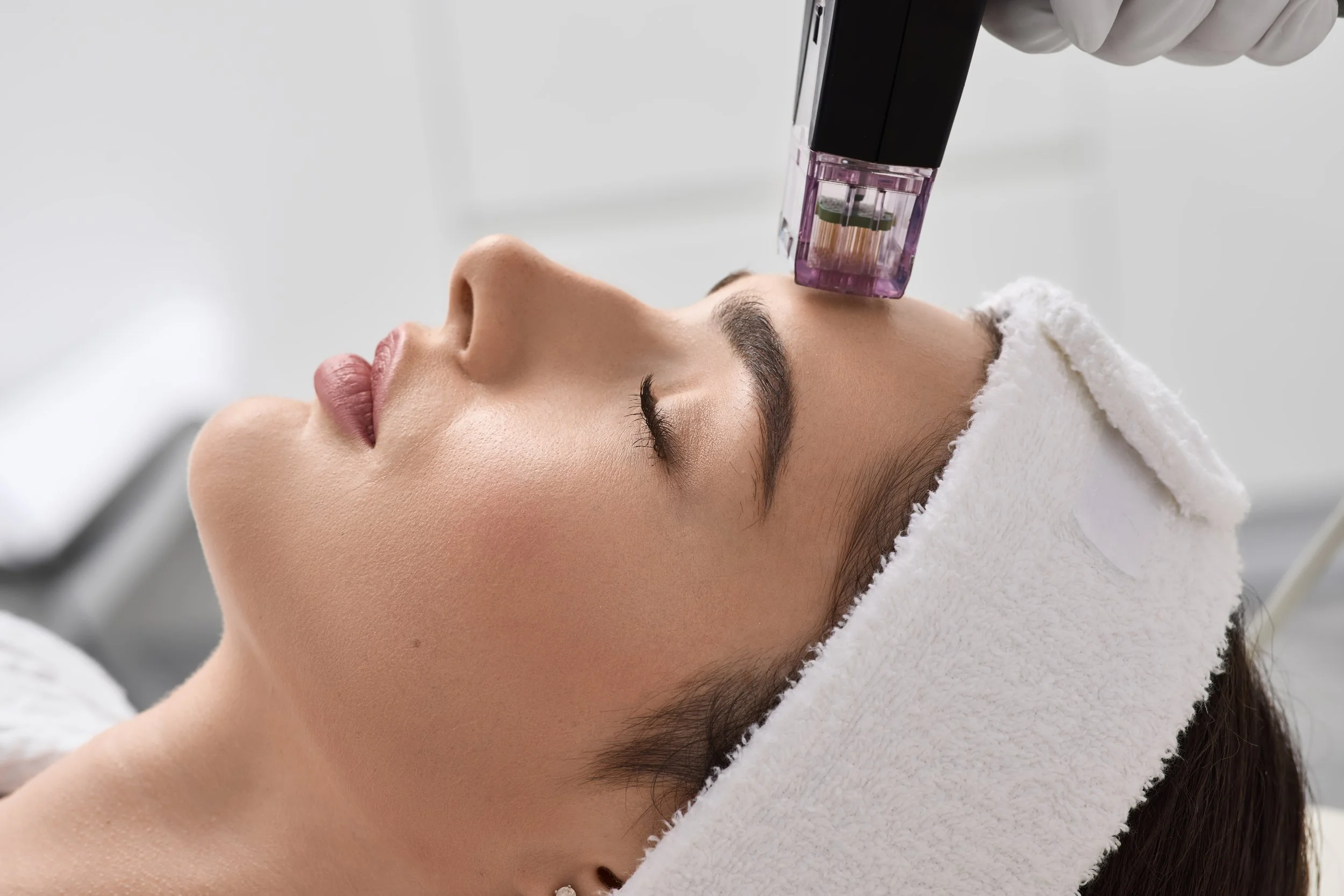 How Radio Frequency Treatments Melt Fat and Boost Collagen