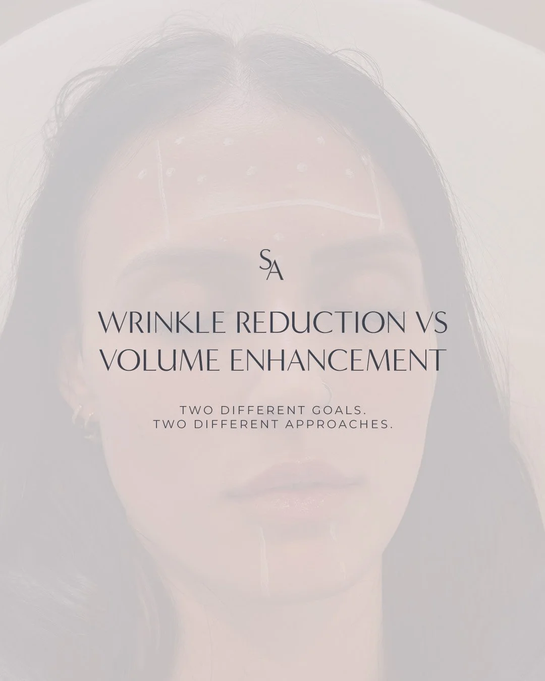 Wrinkle reduction vs volume enhancement, they might sound similar, but they&rsquo;re designed for two totally different goals.

Wrinkle reduction targets expression lines caused by movement (forehead, frown lines, crow&rsquo;s feet) for a smoother, m