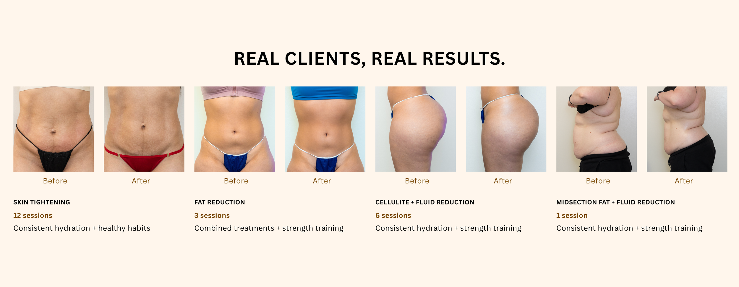 Musa Body Sculpting