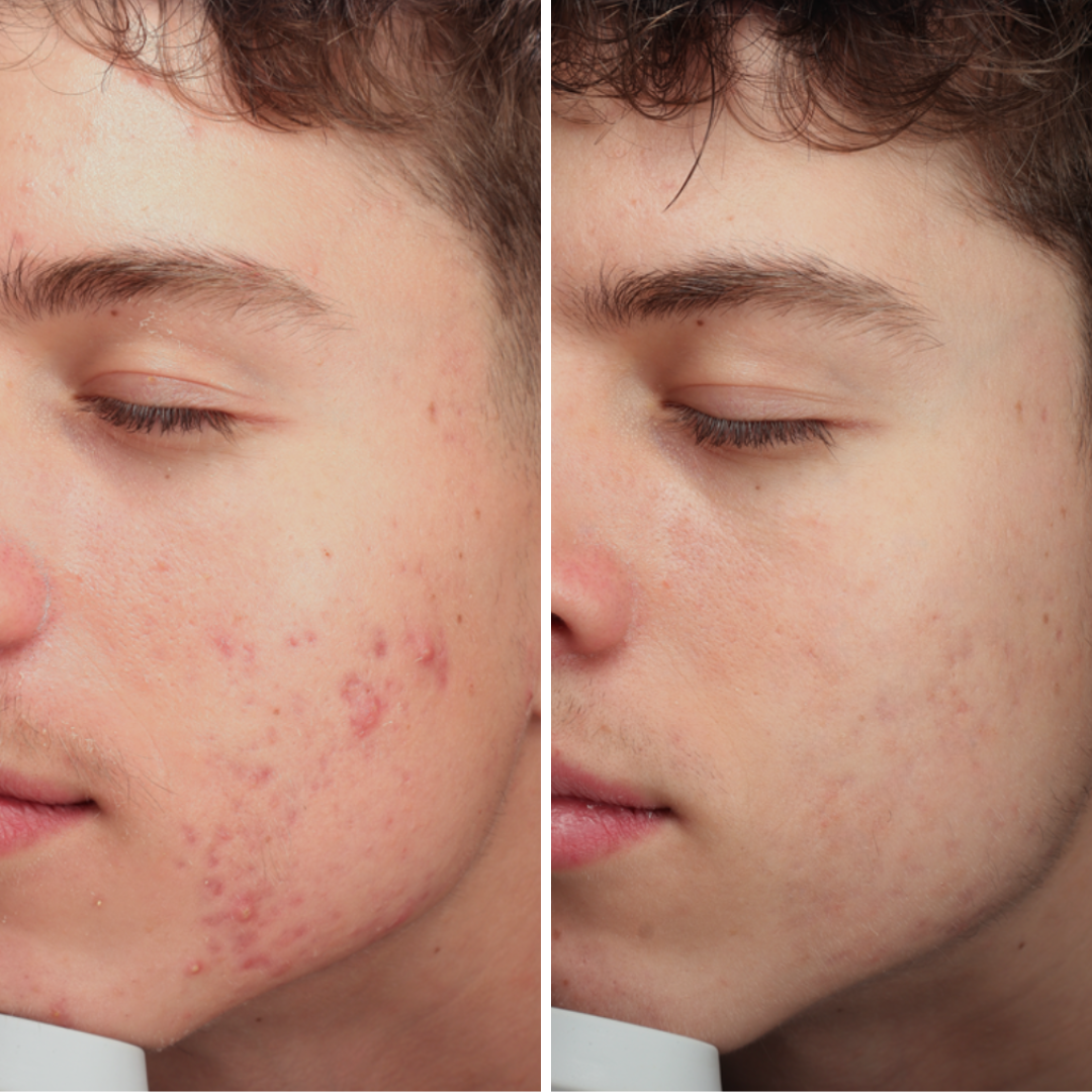 WEBSITE CAROUSEL ARTWORK.png