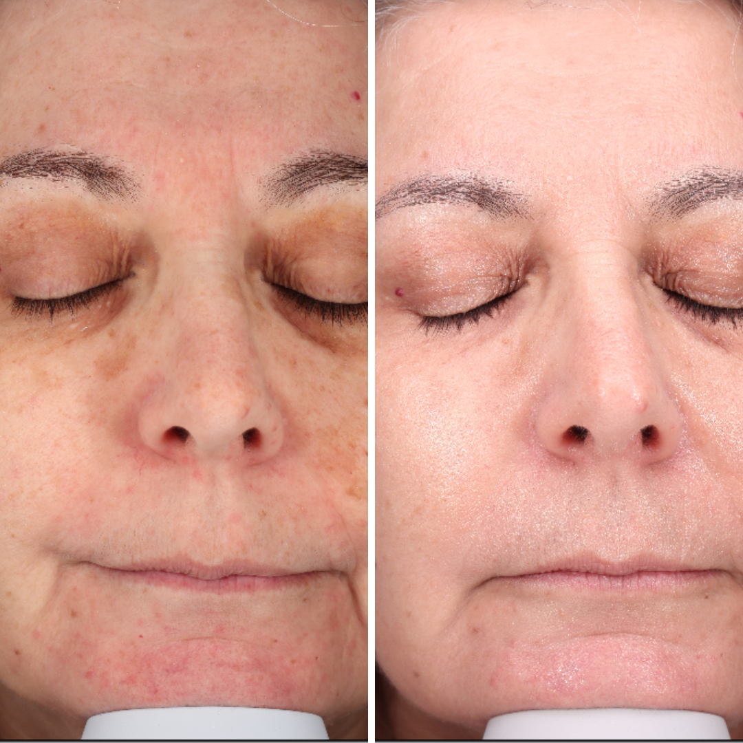 WEBSITE CAROUSEL ARTWORK.png