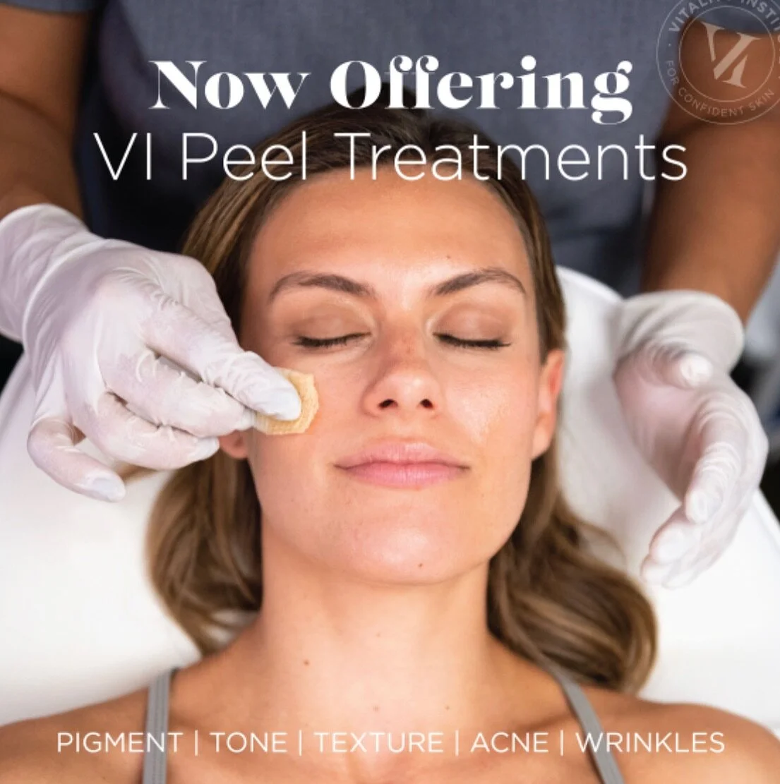 Did you hear?! We are now offering @vipeel at Golden! We offer a selection of multiple peels depending on your needs! DM us for more info and be sure to purchase your series of 3 to keep your skin looking AMAZING through the holidays! &bull;
&bull;
&
