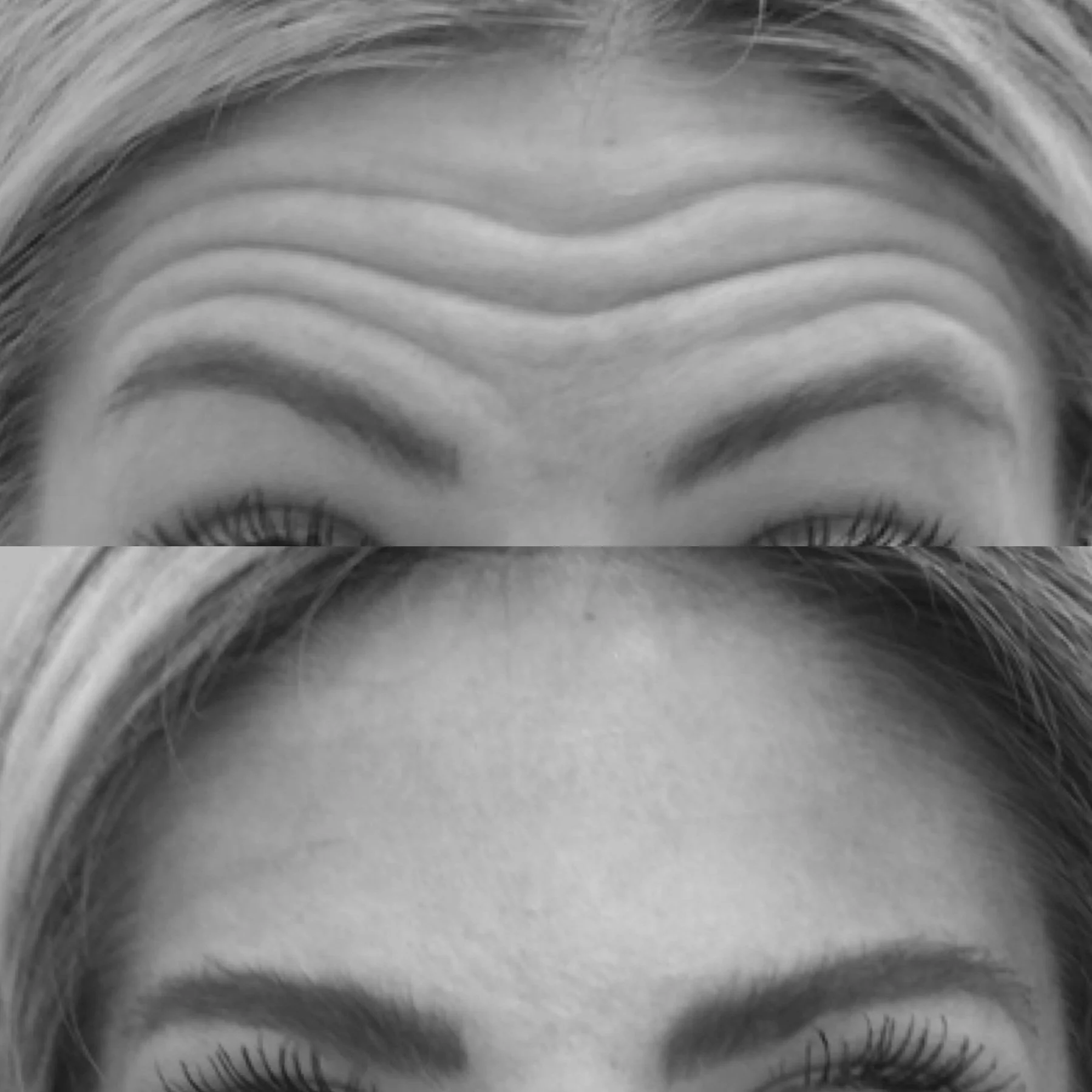 botox dysport filler spa facial louisville lexington kentucky