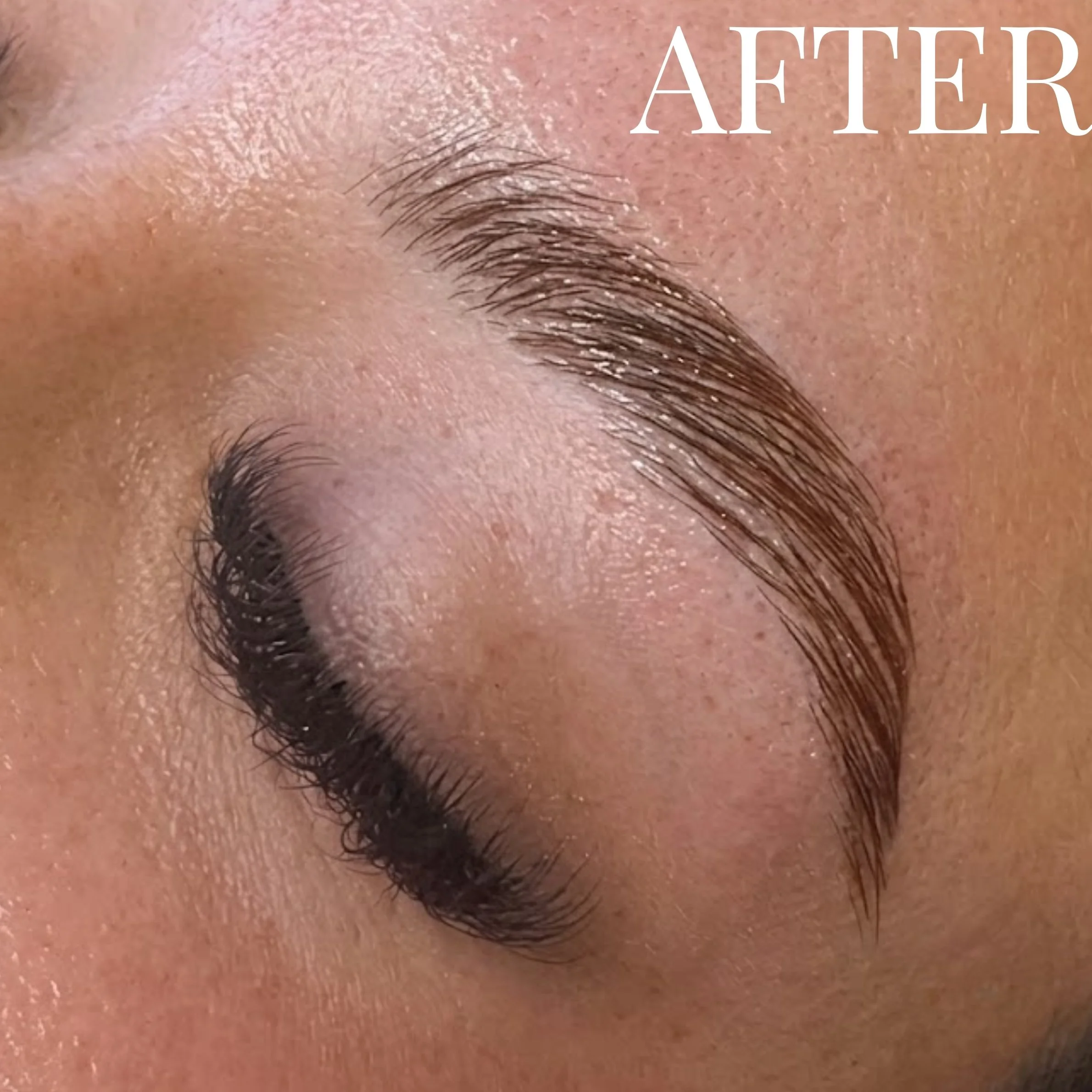 The Crucial Before &amp; After.jpg