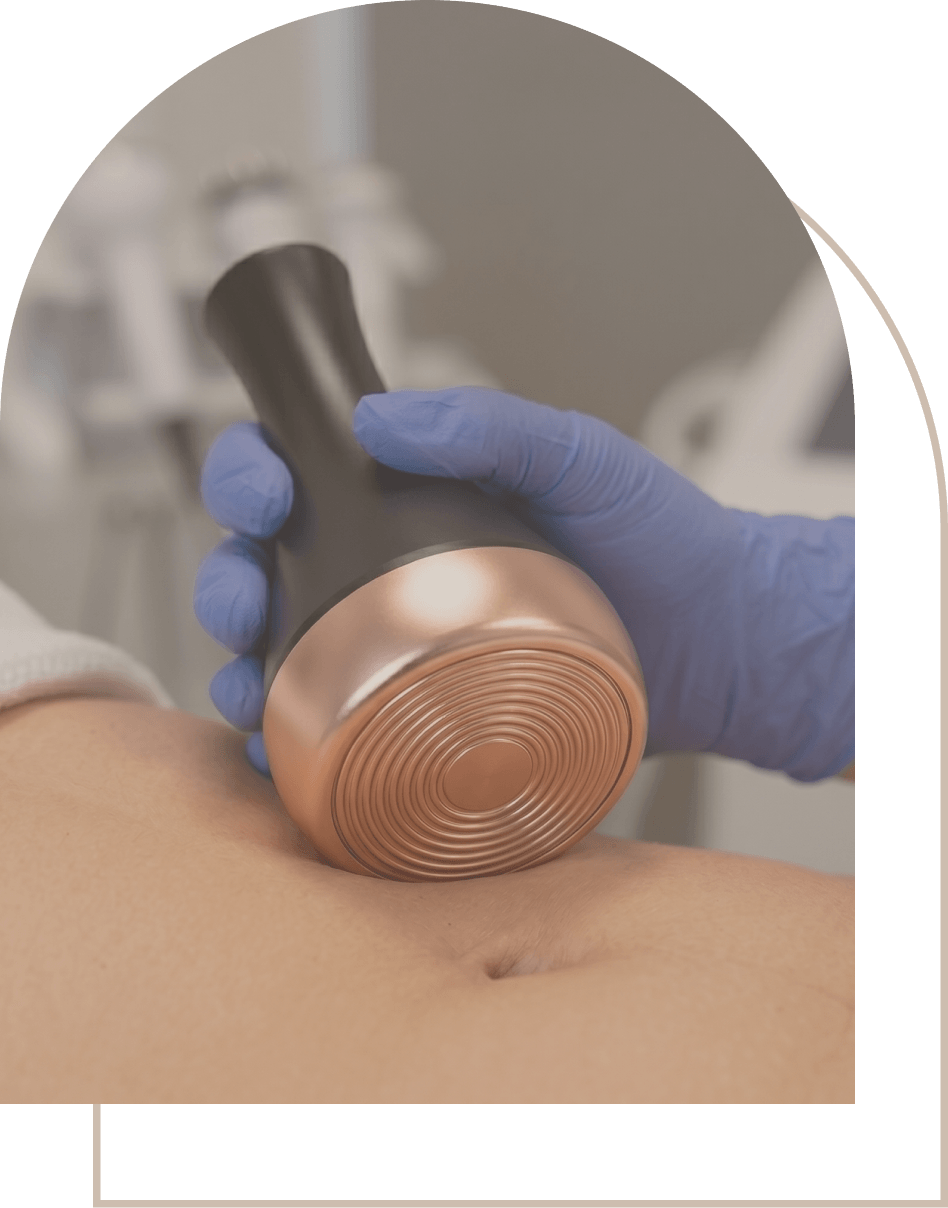 NO PAIN. NO DOWNTIME